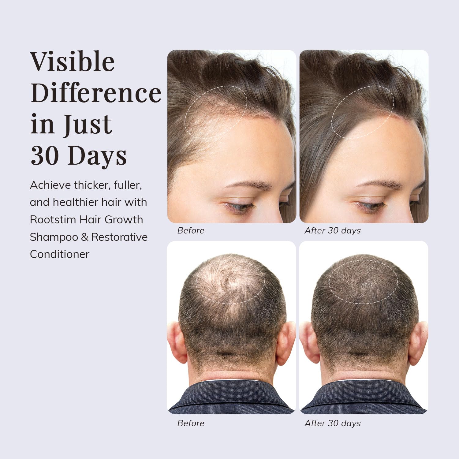 RootStim Hair Growth Shampoo and Conditioner Set for Thinning Hair - RootStim Official Product View 5