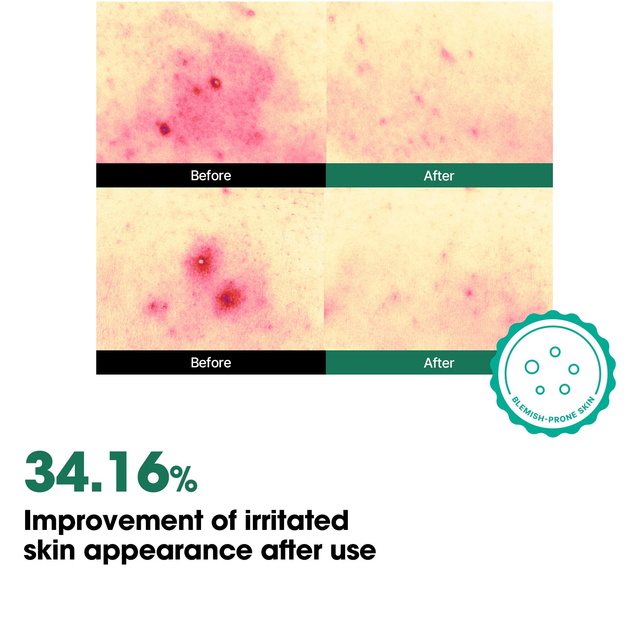 SOME BY MI AHA BHA PHA 30 Days Miracle Body Toner Mist – 4. , – Body Spray for - SOME BY MI Official Product View 8