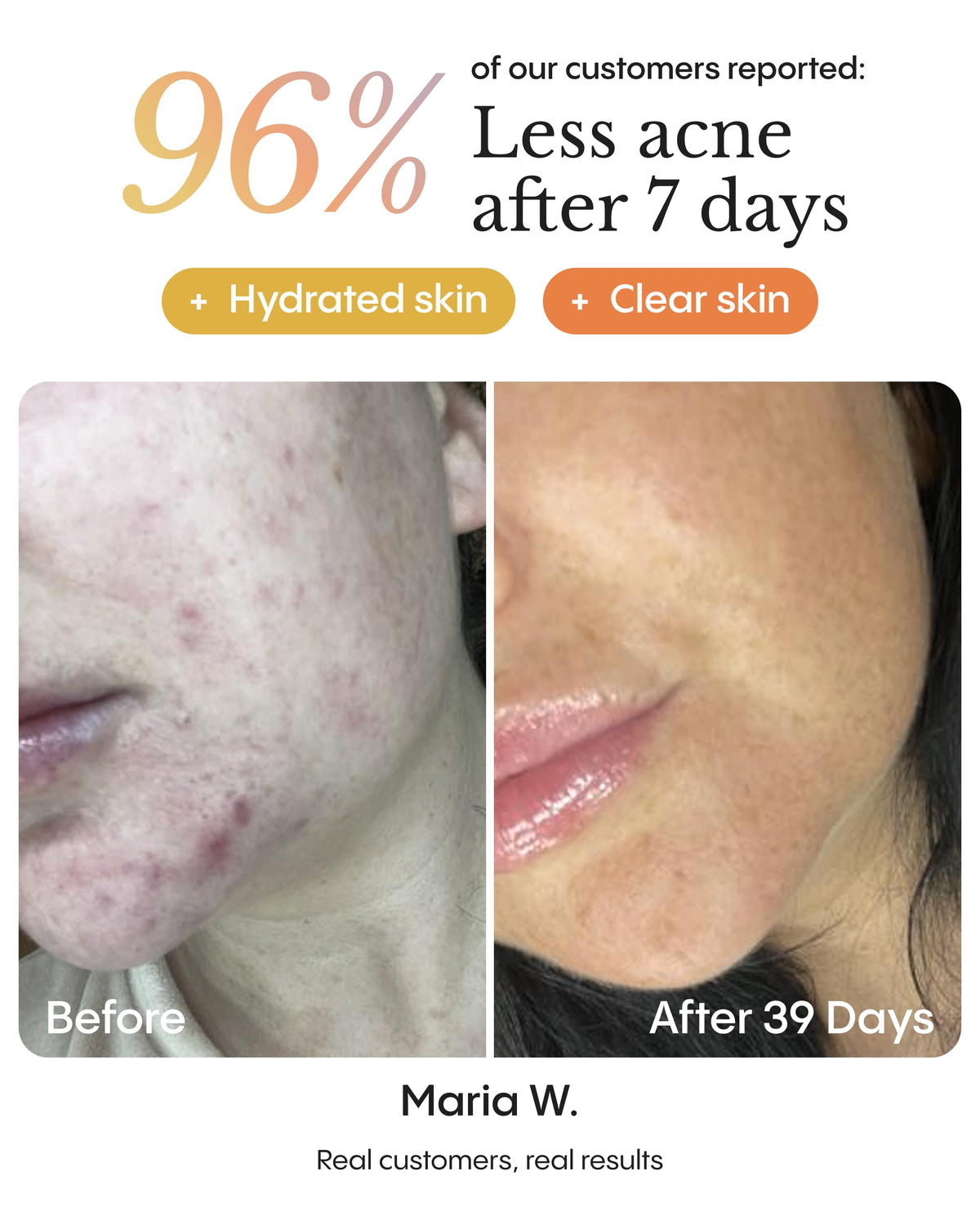 FR YA Organics Instant Blemish Redness Stopper Balm for Face - FRØYA Official Imagery - 7