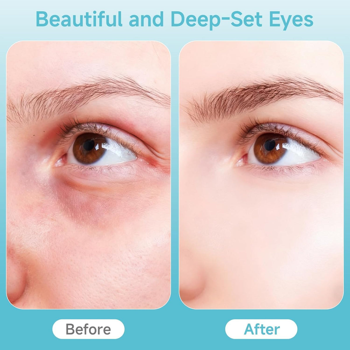 Depuffing Wand for Eyes Face 2 in 1 Hot Cold Eye Facial - Ructmou Official Imagery - 6