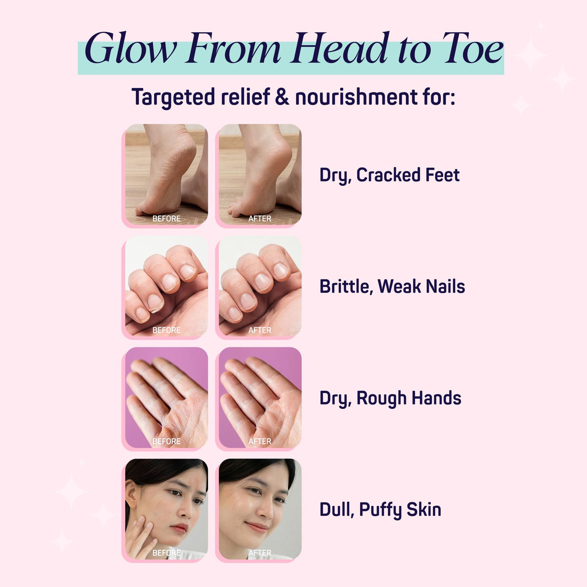 SpaLife 10 Piece Korean Face Mask Moisturizing Hand Gloves - SpaLife Official Product Imagery - 4