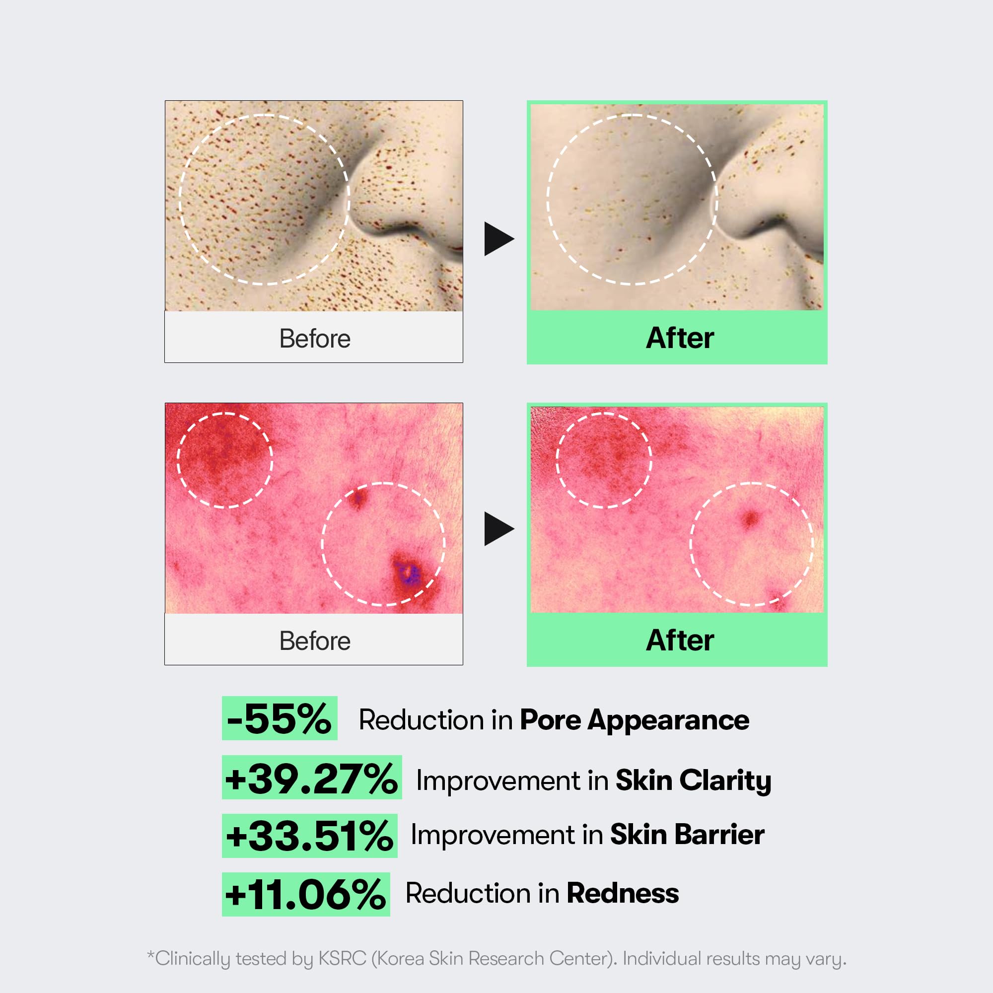 VT COSMETICS CICA Reedle Shot 100 Microneedling Serum - View 7