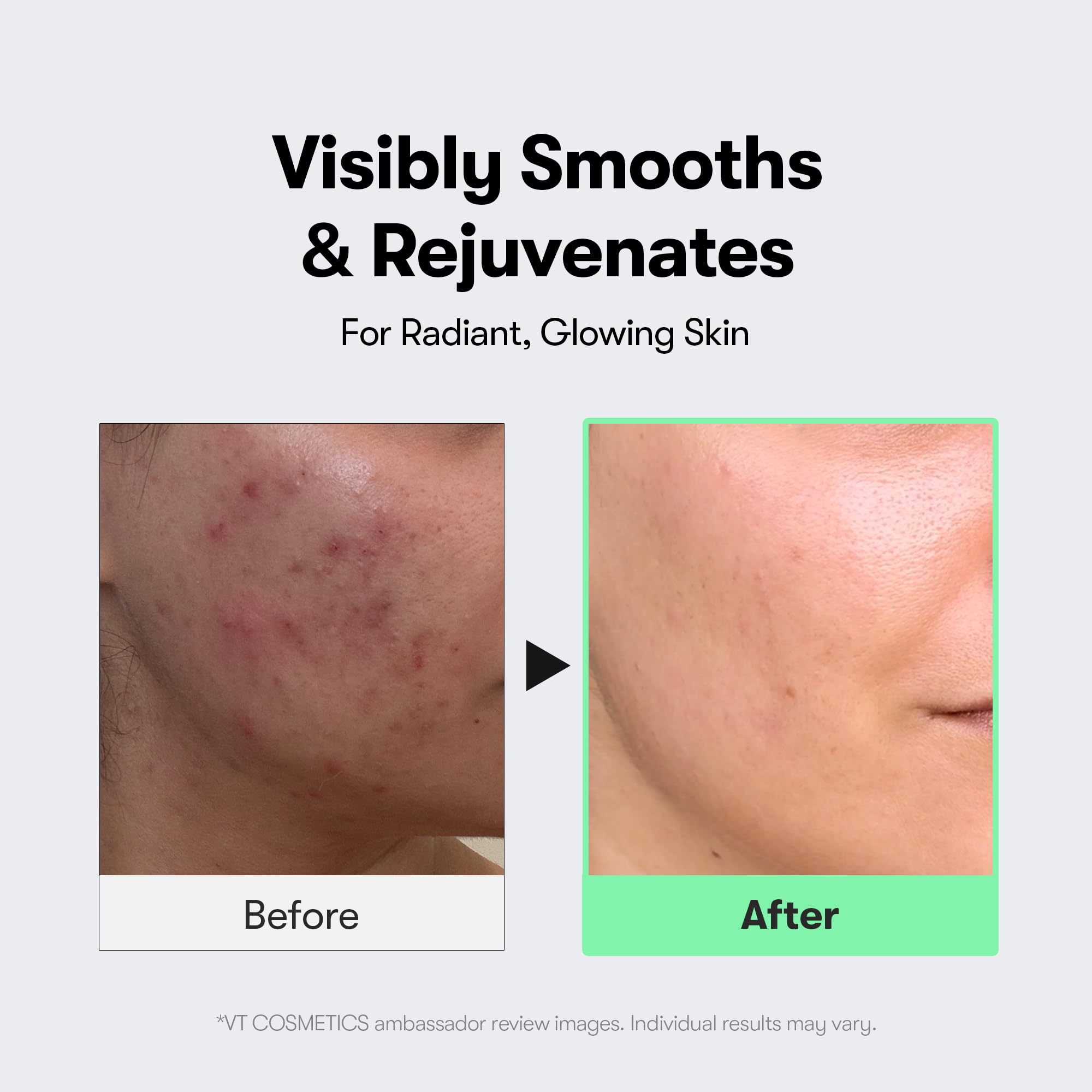 VT COSMETICS CICA Reedle Shot 100 Microneedling Serum - View 6