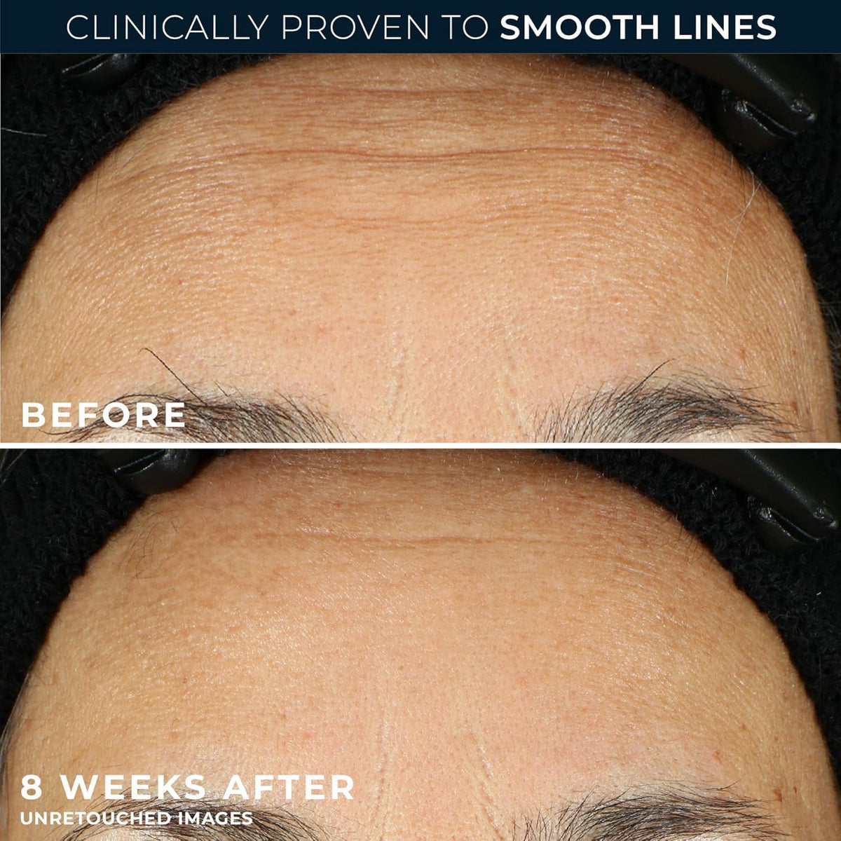 RoC Retinol Correxion Anti Aging Wrinkle Night Serum - RoC Official Imagery - 5