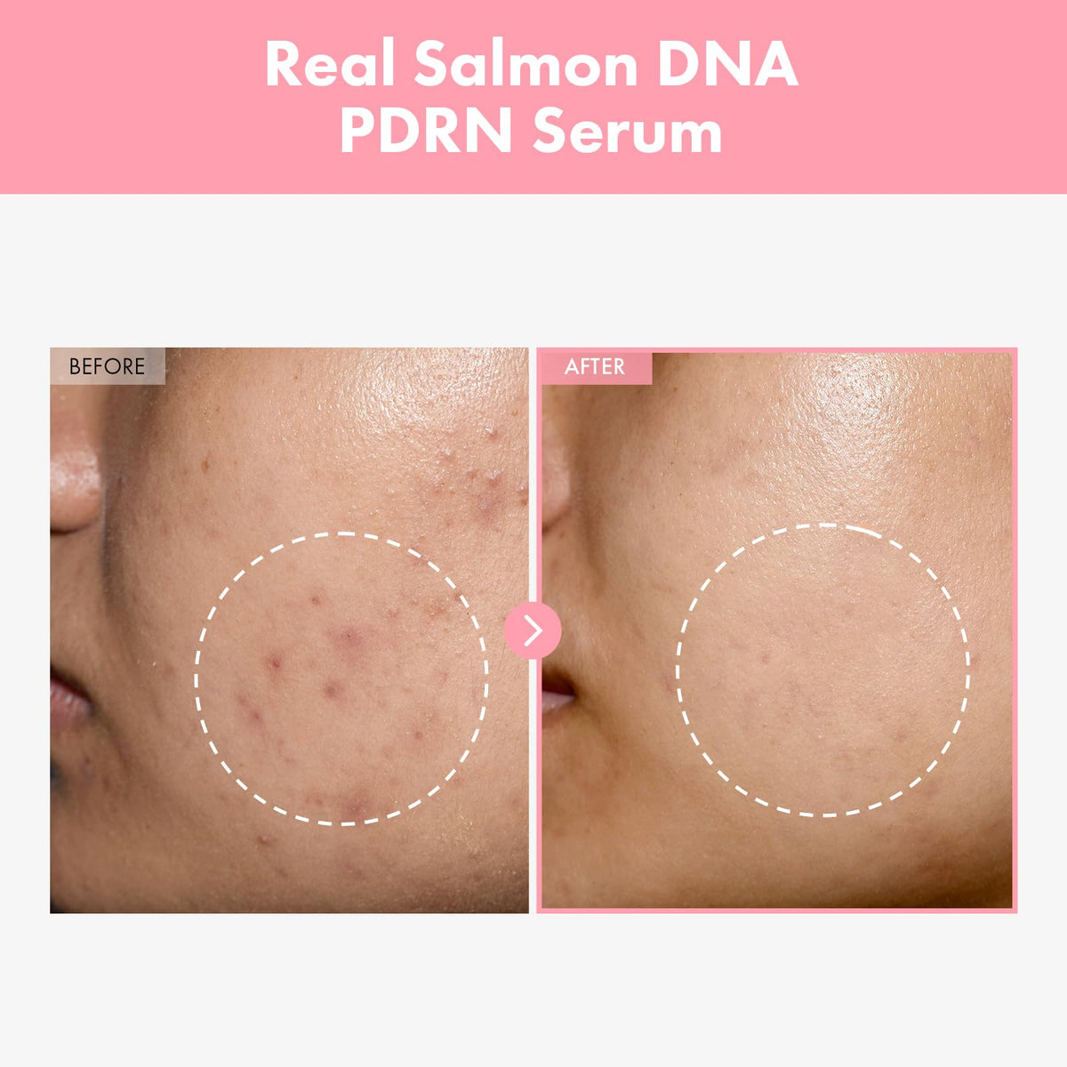 TOSOWOONG Double PDRN Glow Bundle Hydrating Pink Niacinamide - TOSOWOONG Official Imagery - 8