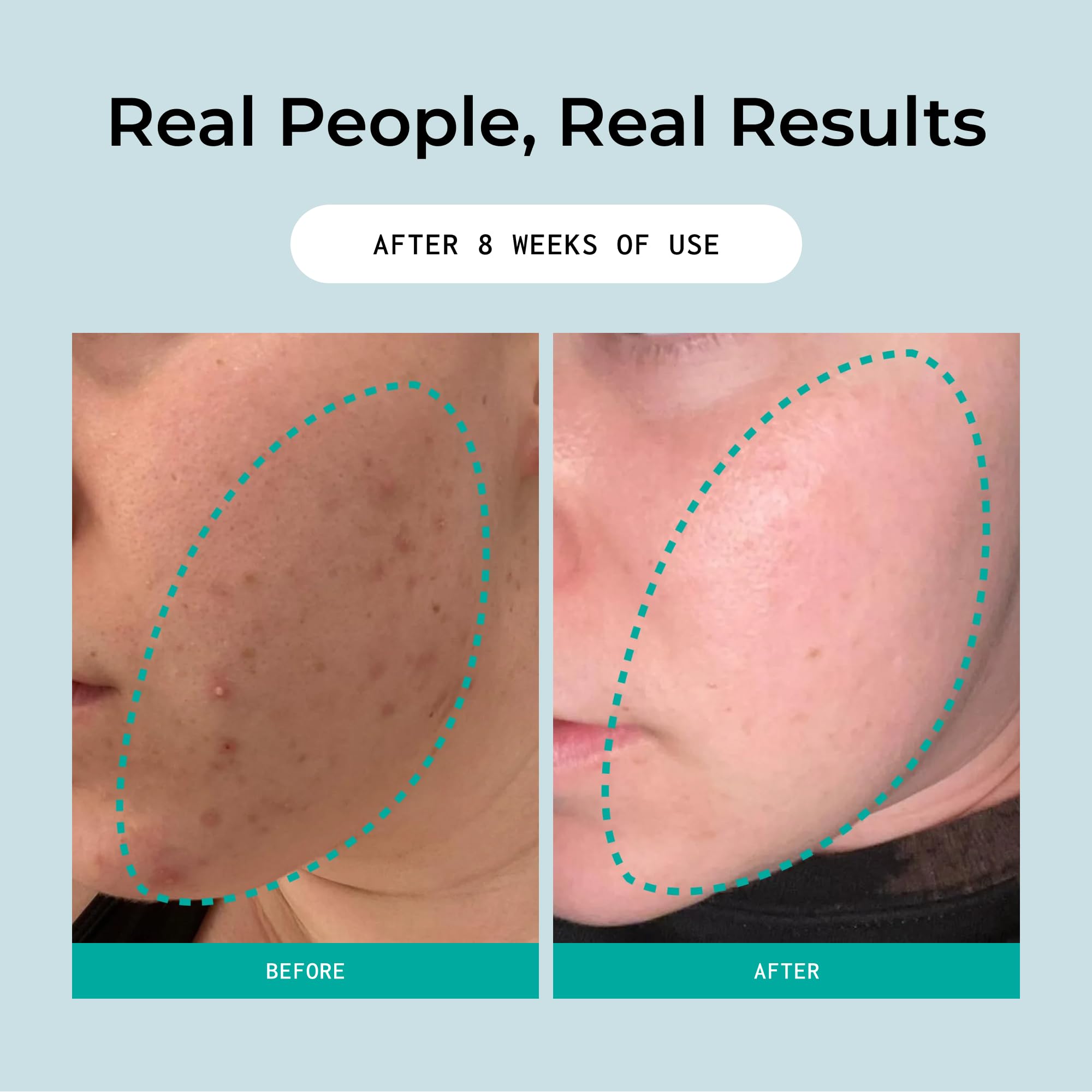 Bigger Than Beauty Overnight Sensation Retexturizing Solution, - Bigger Than Beauty Skincare