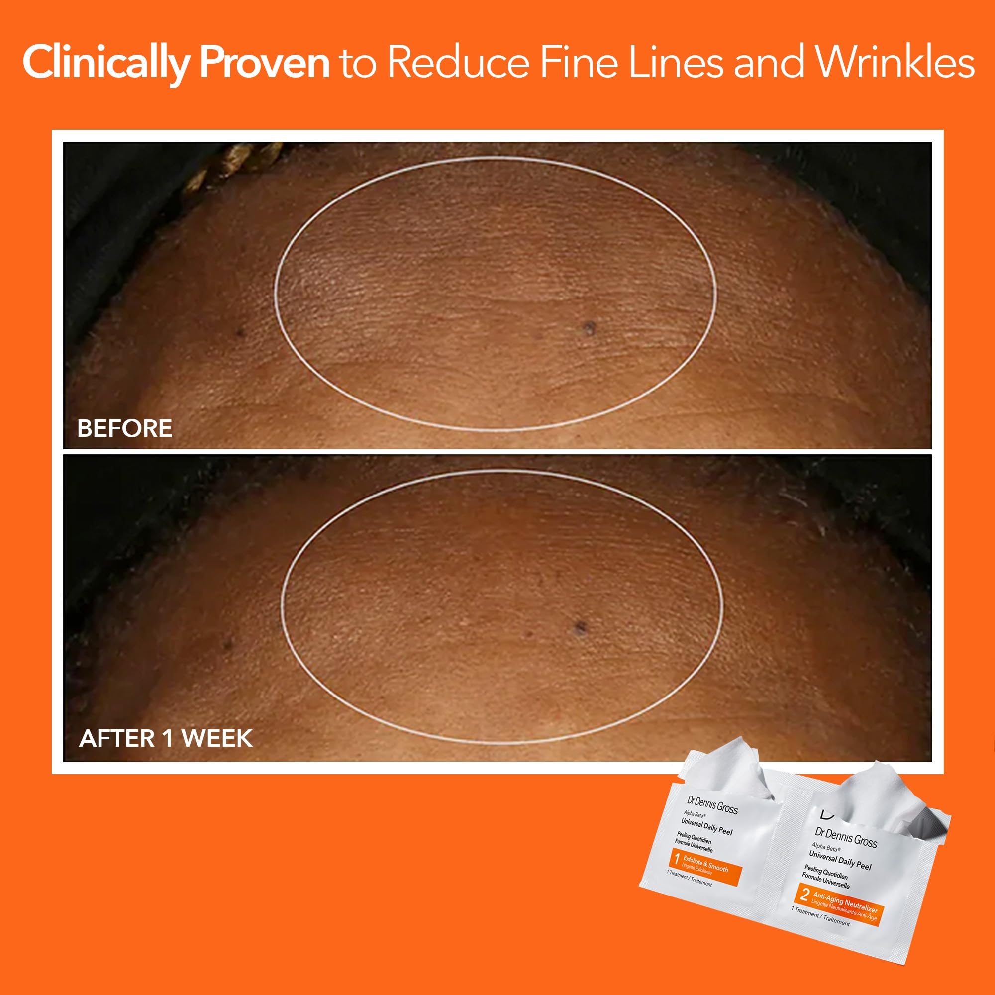 Dr Dennis Gross Alpha Beta Universal Exfoliating Daily Peel - Dr Dennis Gross