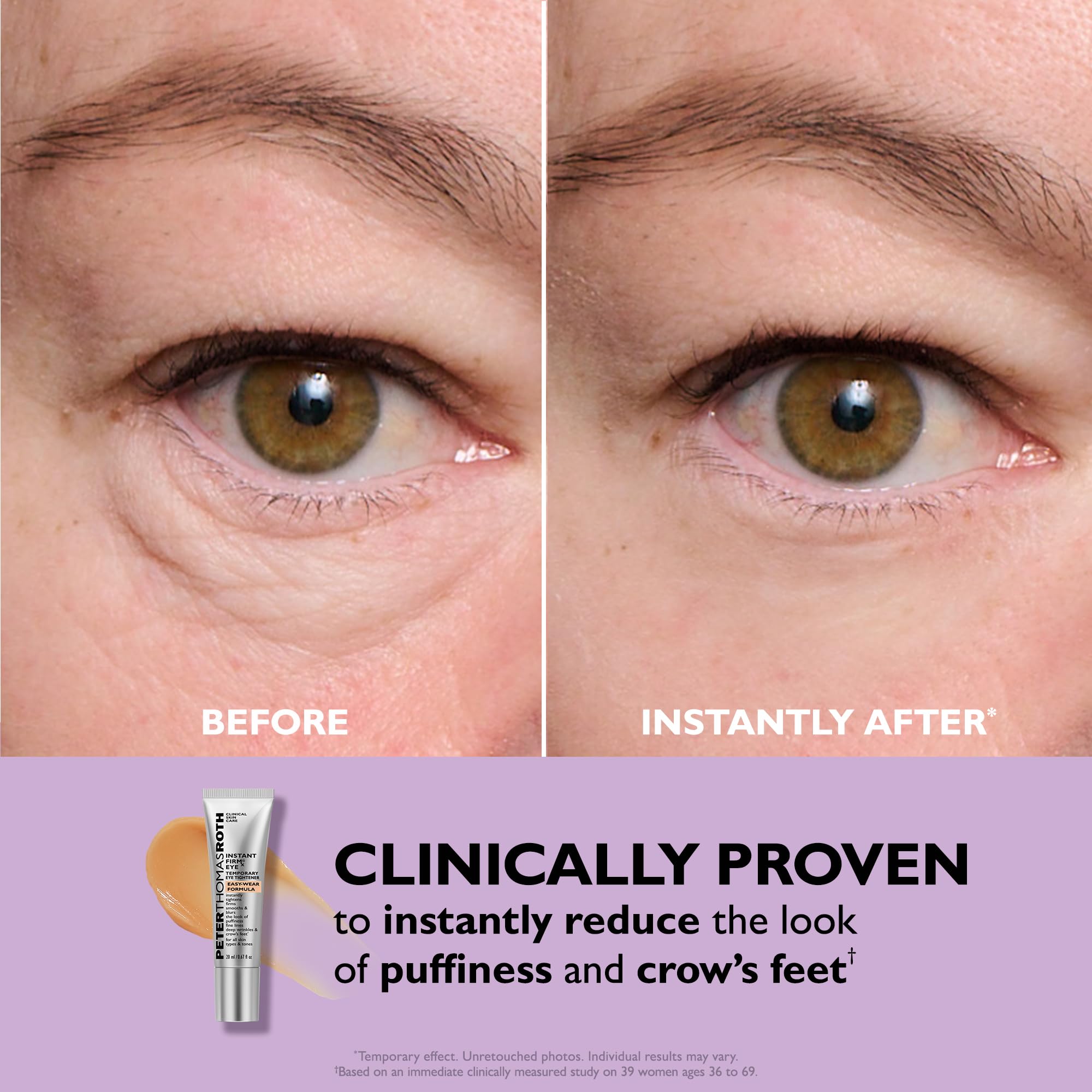 Elefair Tech Peter Thomas Roth - Instant FIRMx® Eye Temporary Eye Tight - Elefair Tech Official Product View 5