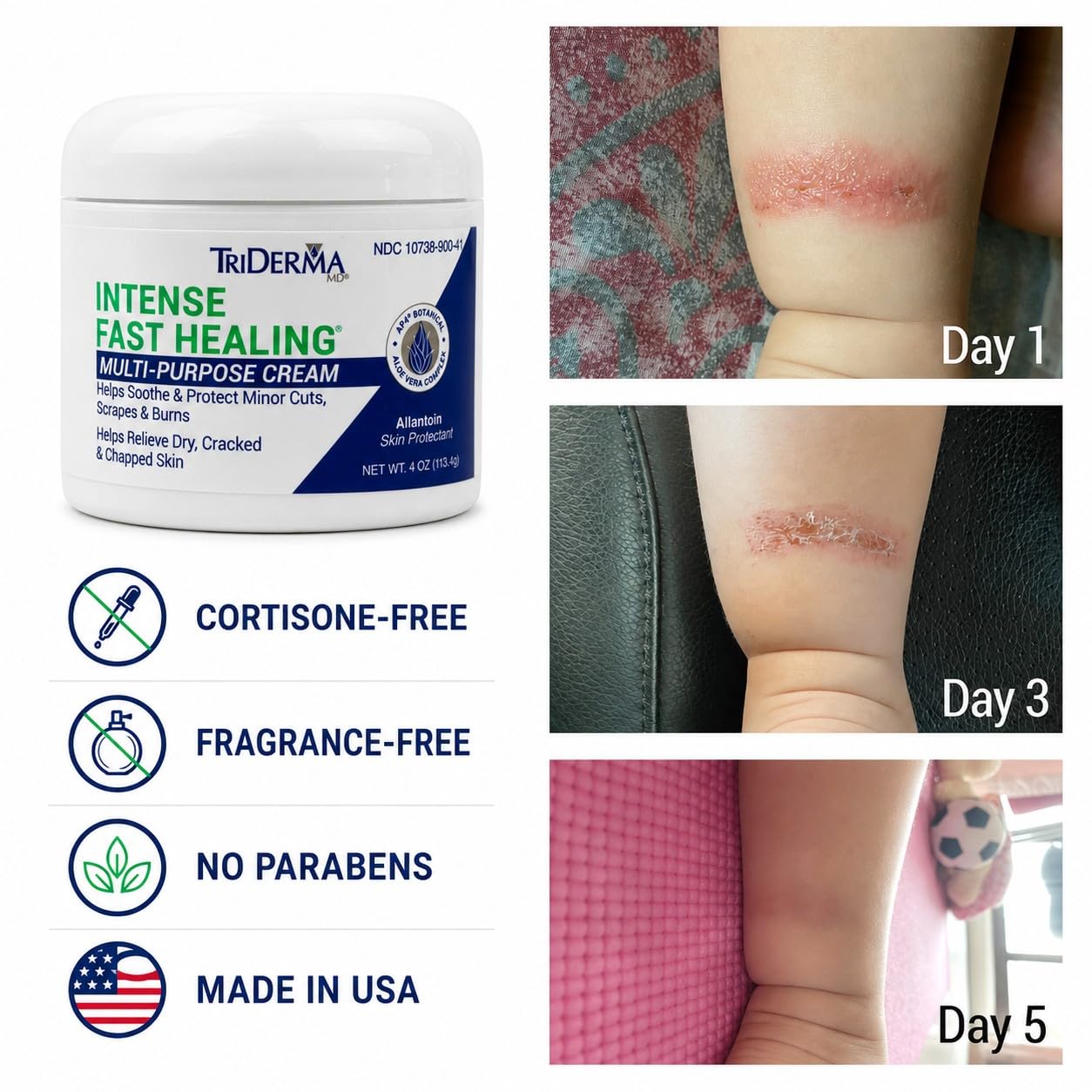 TriDerma Intense Fast Healing Cream Decreases Healing Time - TriDerma Official Imagery - 5