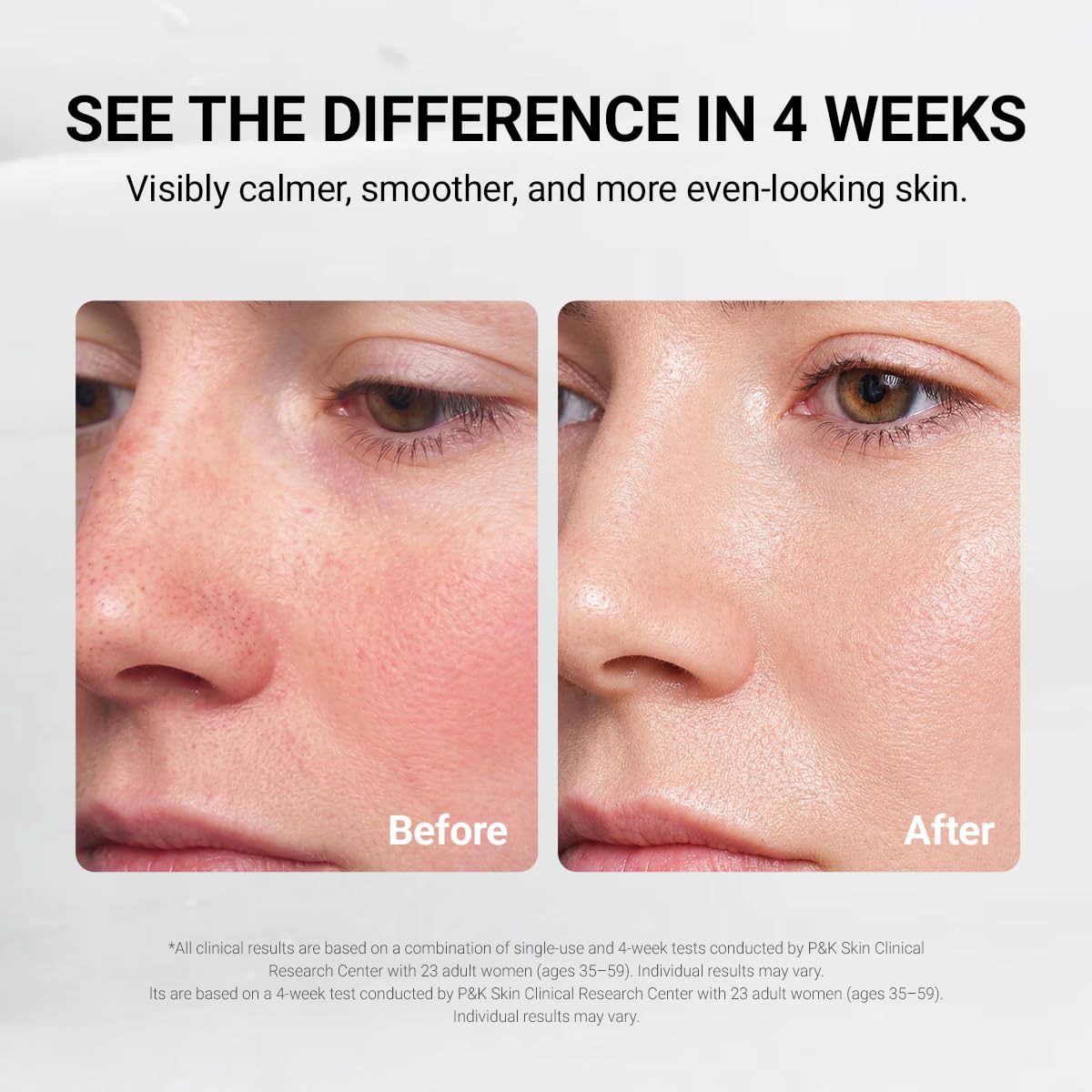 DA EFFECT Post Care Balm Post Laser Recovery Cream for Skin - DA EFFECT Official Imagery - 4