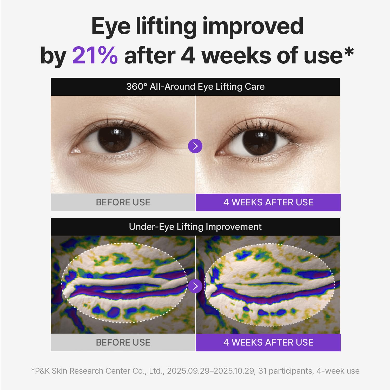 CENTELLIAN 24 360 Shot PDRN Firming Eye Cream, TECA Retinol Care - CENTELLIAN 24 Official Product View 5