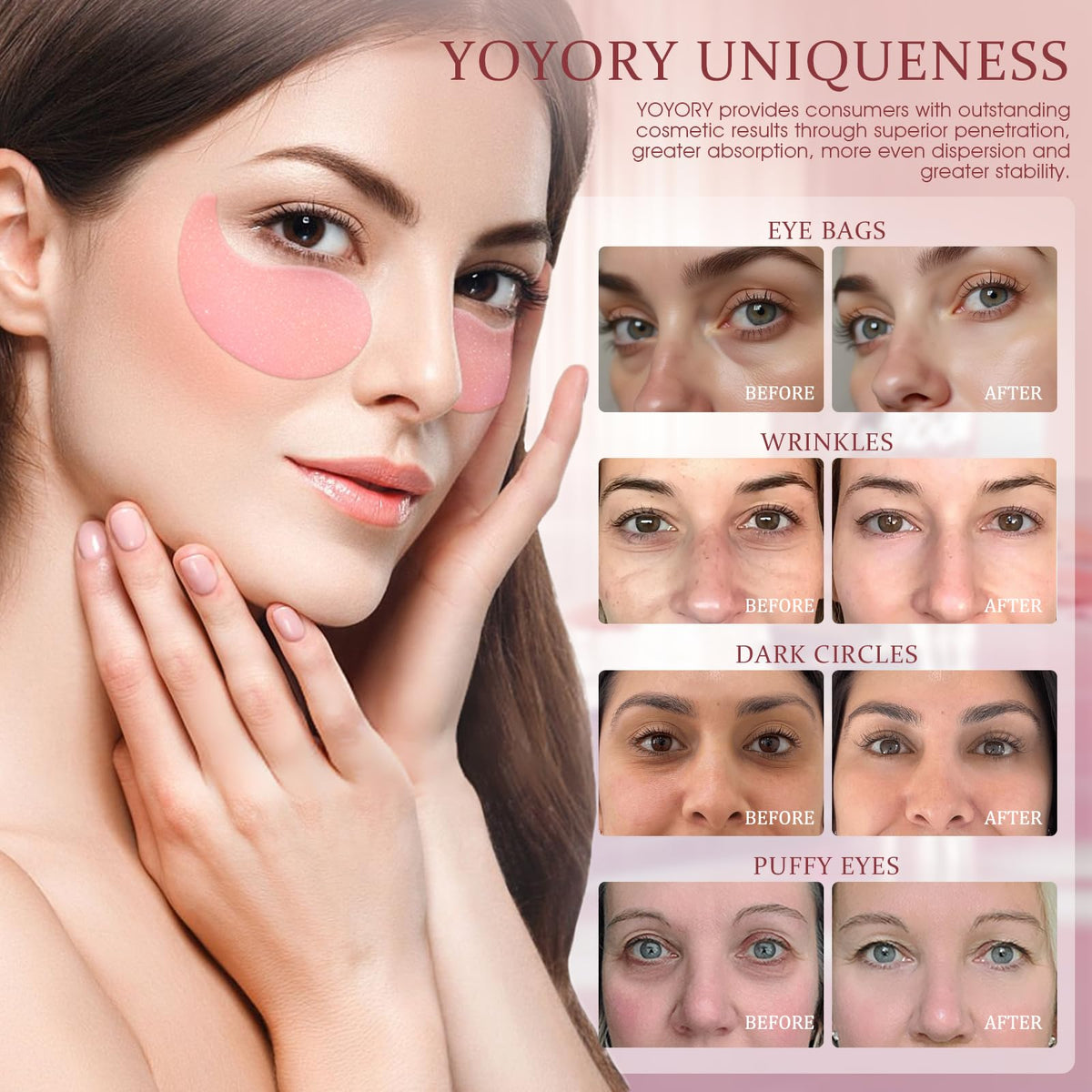Under Eye Patches Masks - YOYORY Official Imagery - 4