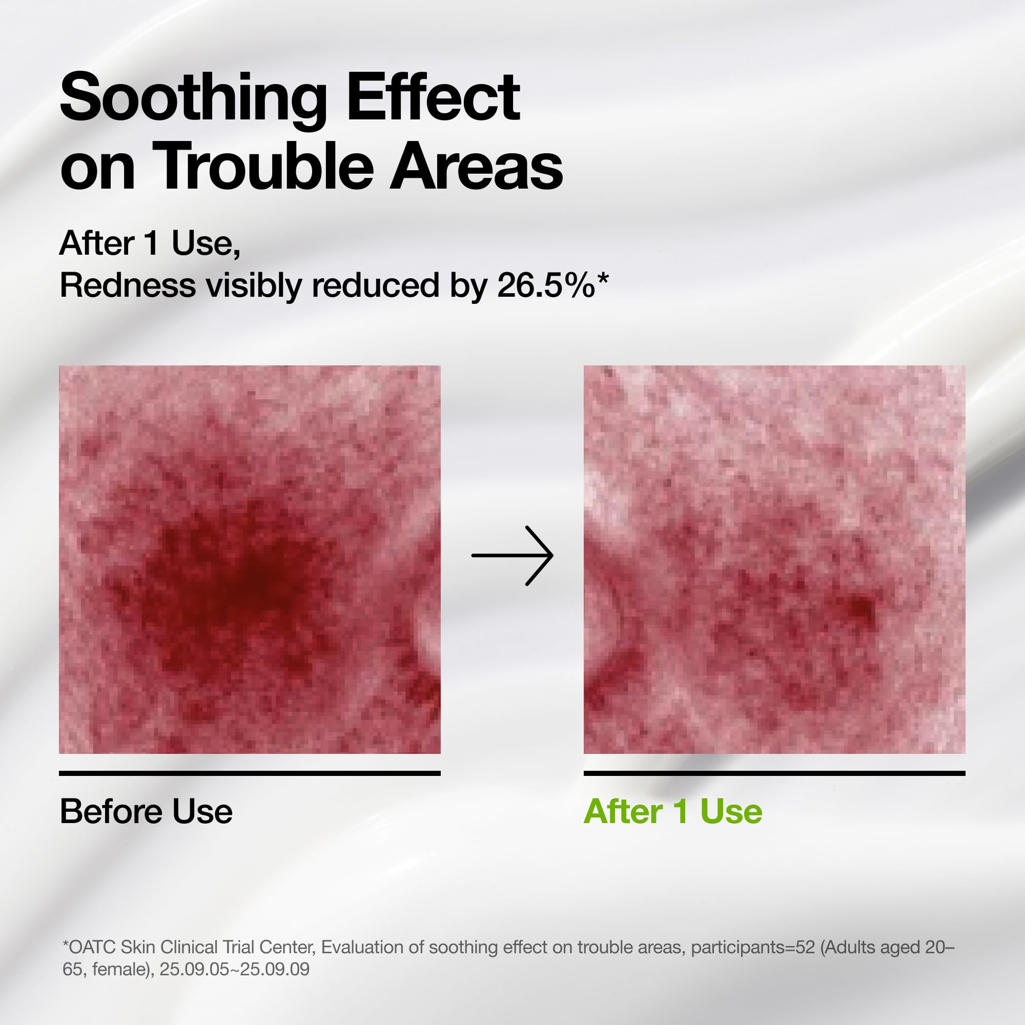 ANUA Azelaic Acid CICA Skin Soothing Moisturizer, 3.38 fl oz - ANUA Official Product View 9
