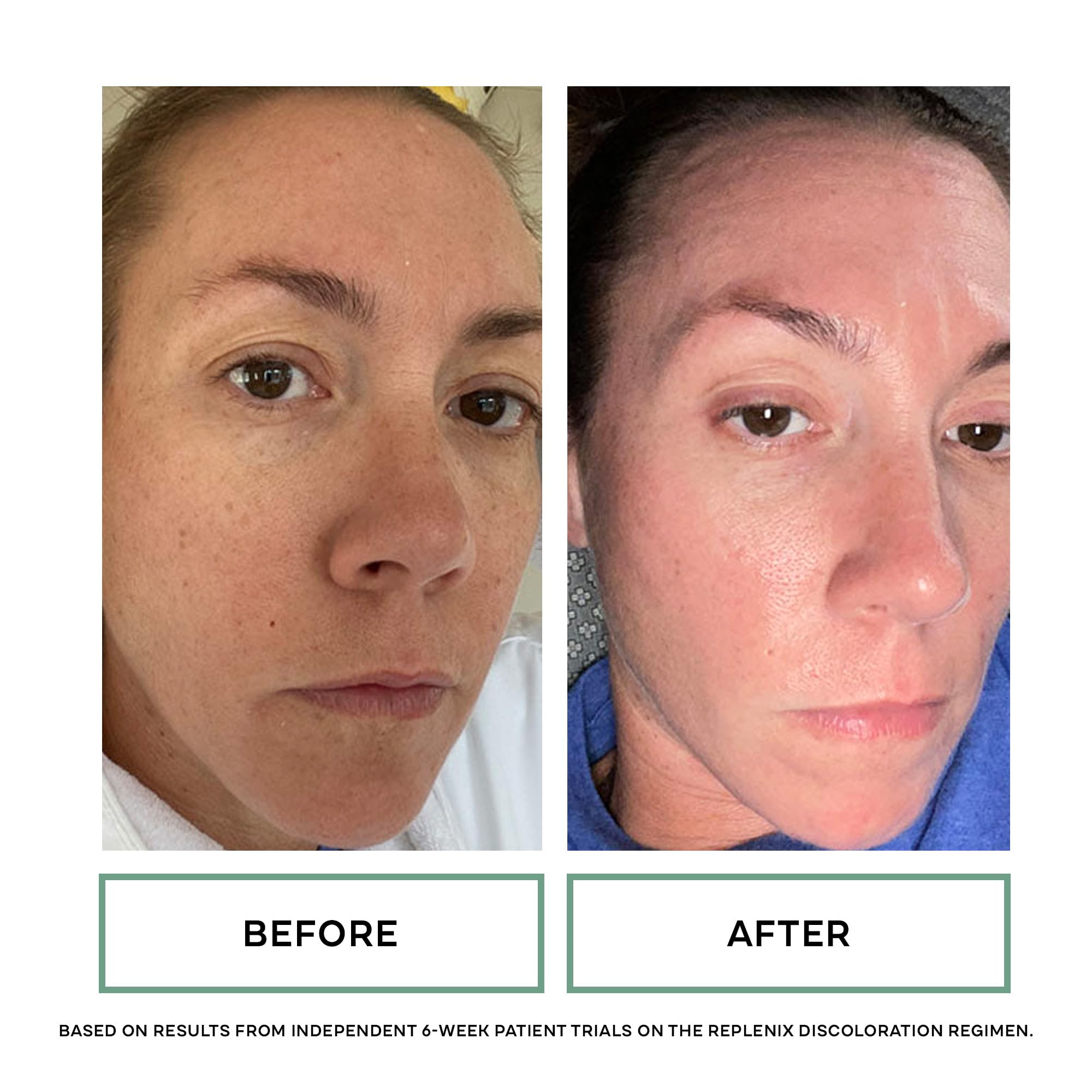Replenix Glycolic Acid Resurfacing Skin Peel Medical Grade - Premium Selection Official Imagery - 6