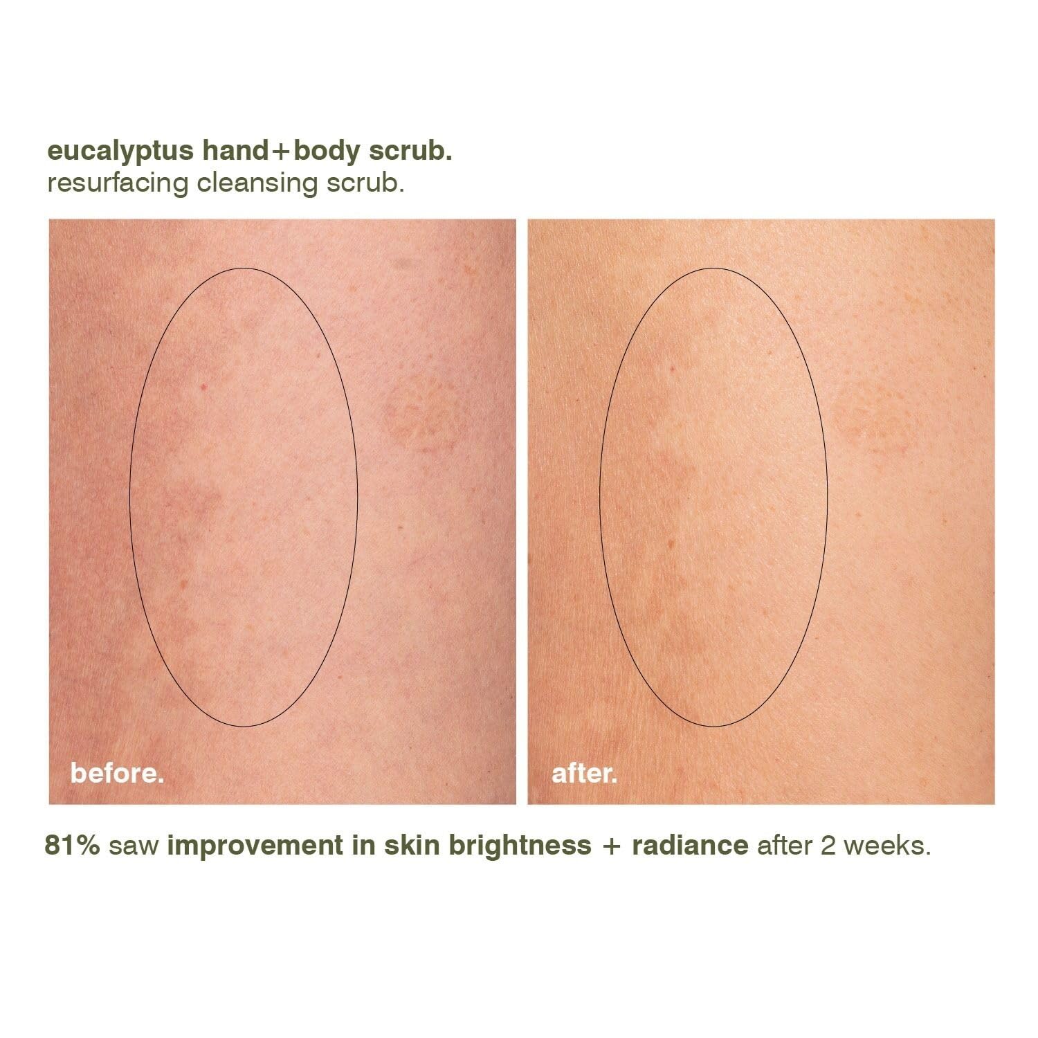 Elefair Tech MALIN+GOETZ Eucalyptus Hand + Body Scrub, Resurfacing Cleanser, - Elefair Tech Official Product View 7