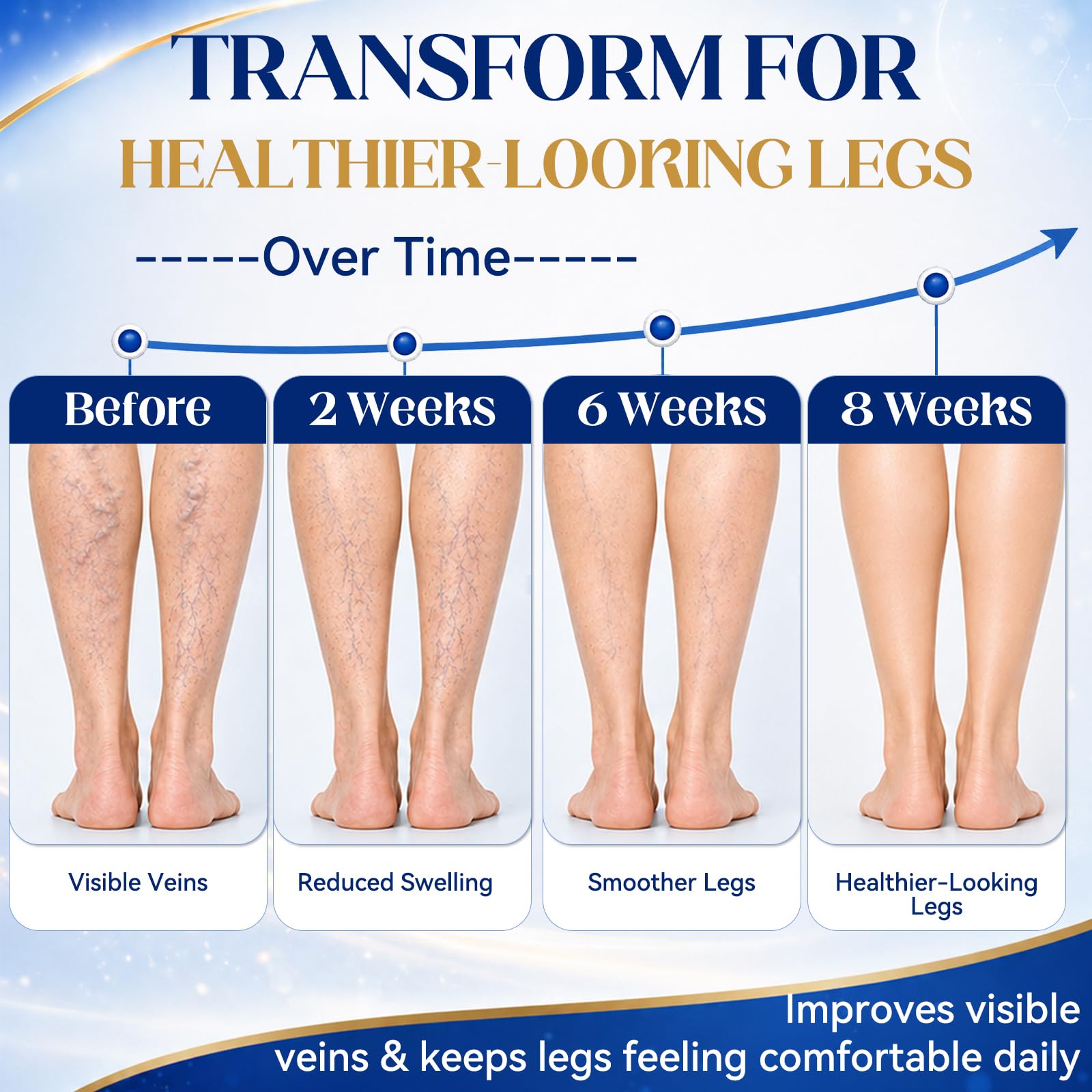JOYAONE Varicose Veins Treatment for Legs, 150g Varicose Veins Cream for Spider Veins, Fast Absorbing Vein Ease Cream Improve Circulation for Tired, Heavy Legs, Relaxing Leg Cream Reduce Swelling