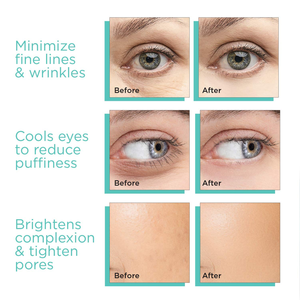 Tighten Skin Depuff Sinus Relief Try Ice Globes for Face - MonétBeauty Official Imagery - 7