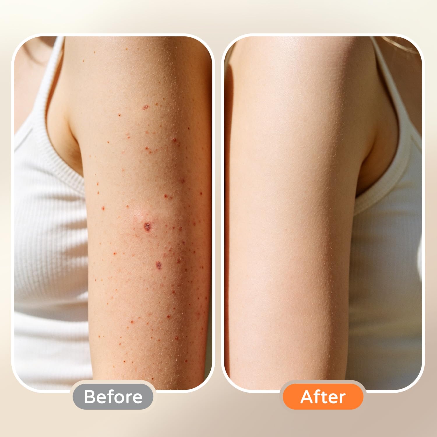 Perme Cream 1oz - ULARCS Official Product Imagery - 3