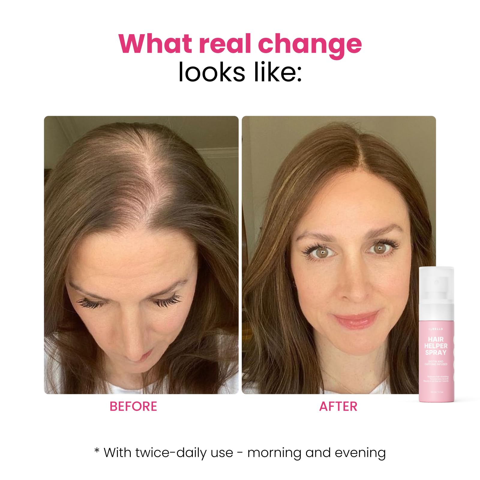 Trybello Hair Helper Spray - DHT Blocker Hair Growth Serum with Bio - Trybello Official Product View 8