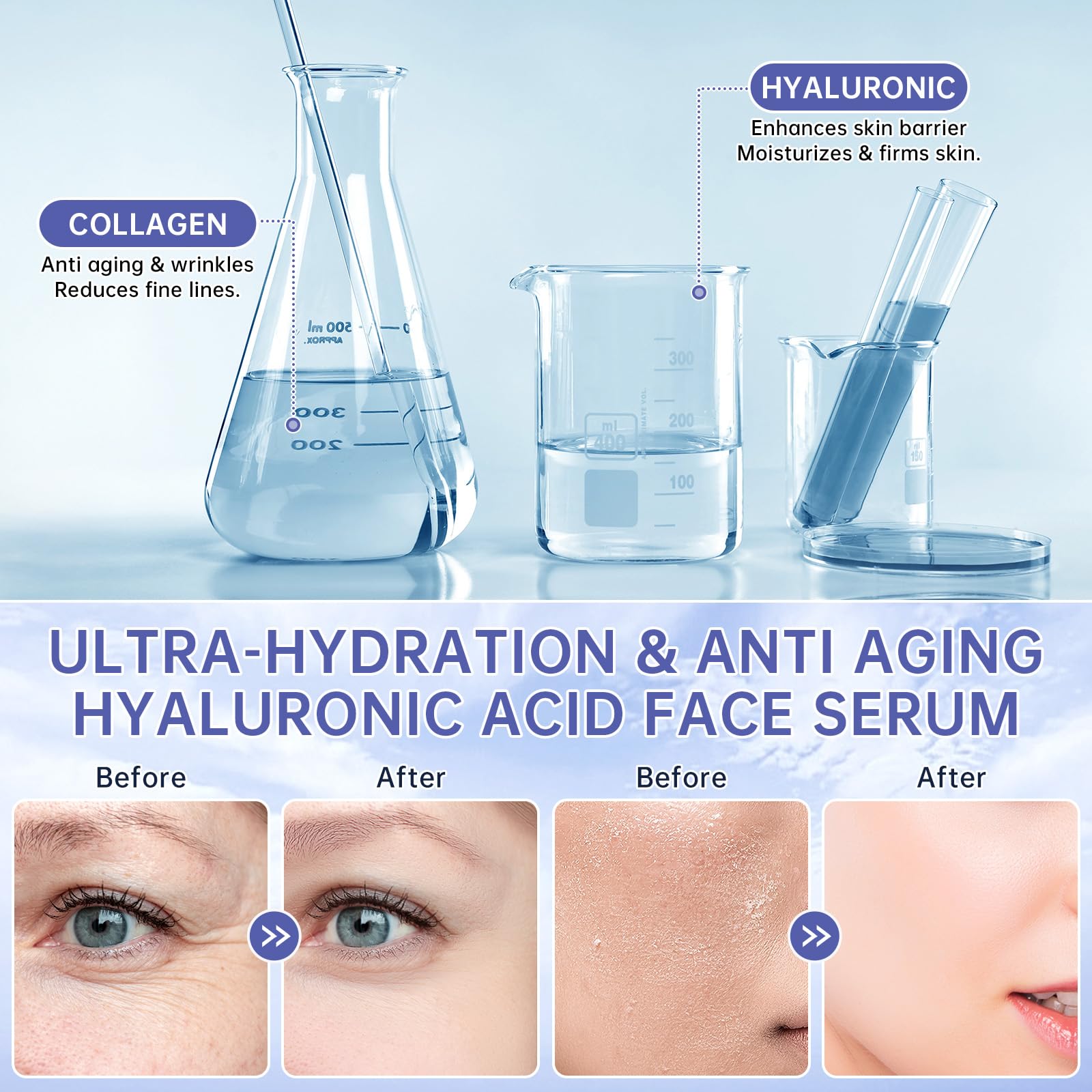 60 Pcs 5 Hyaluronic Acid Serum Ultra Hydrating Vials - mopayzer Official Imagery - 8