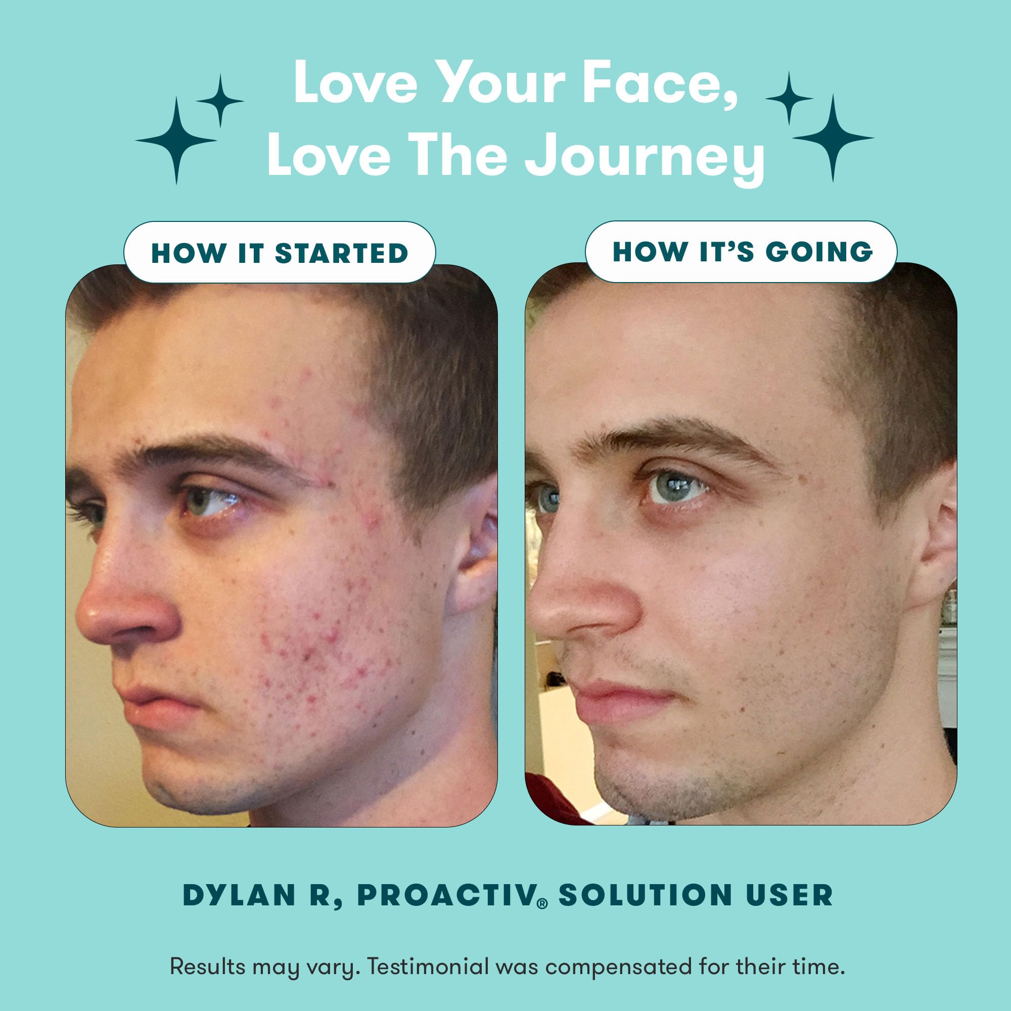 Proactiv 3 Step Acne Treatment System 60 Day Complete - Proactiv Official Imagery - 6