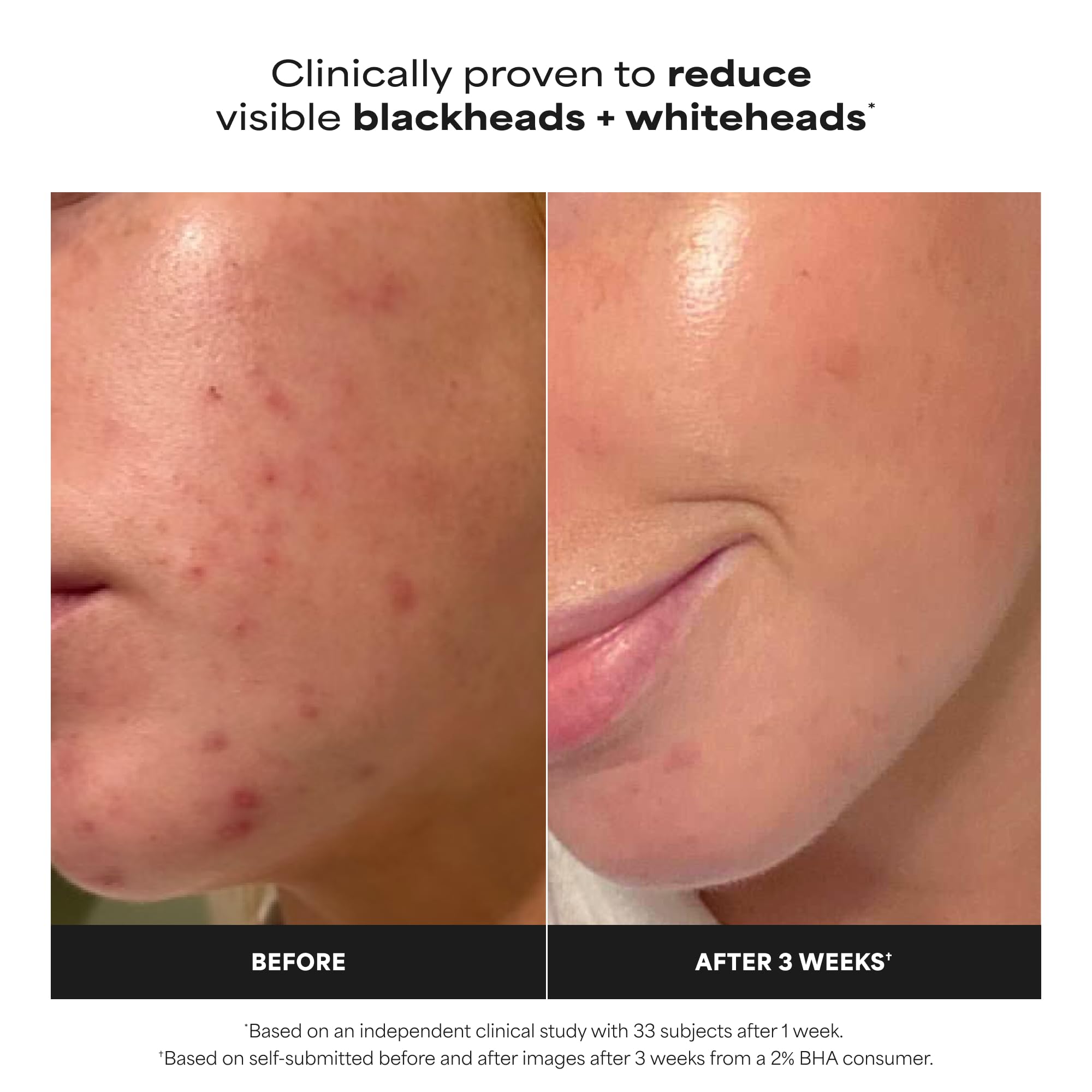 Paula's Choice SKIN PERFECTING 2% BHA Liquid Exfoliant - Elefair Tech Official Product View 4