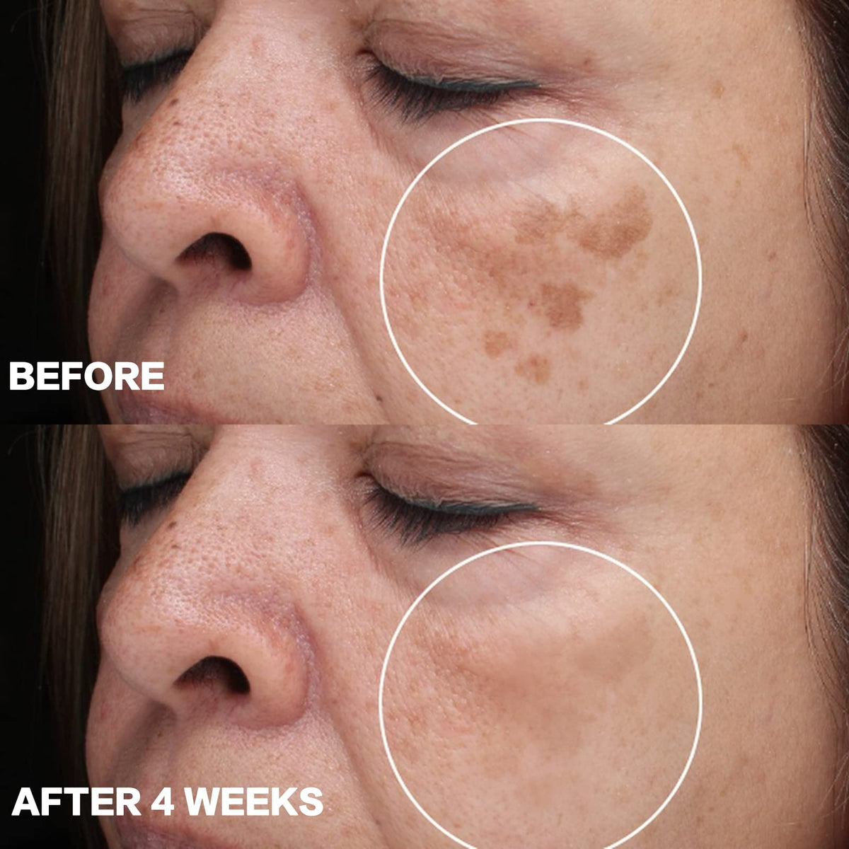 Dark Spot Remover for Face Dark Spot Corrector Cream - CITYGOO Official Imagery - 6