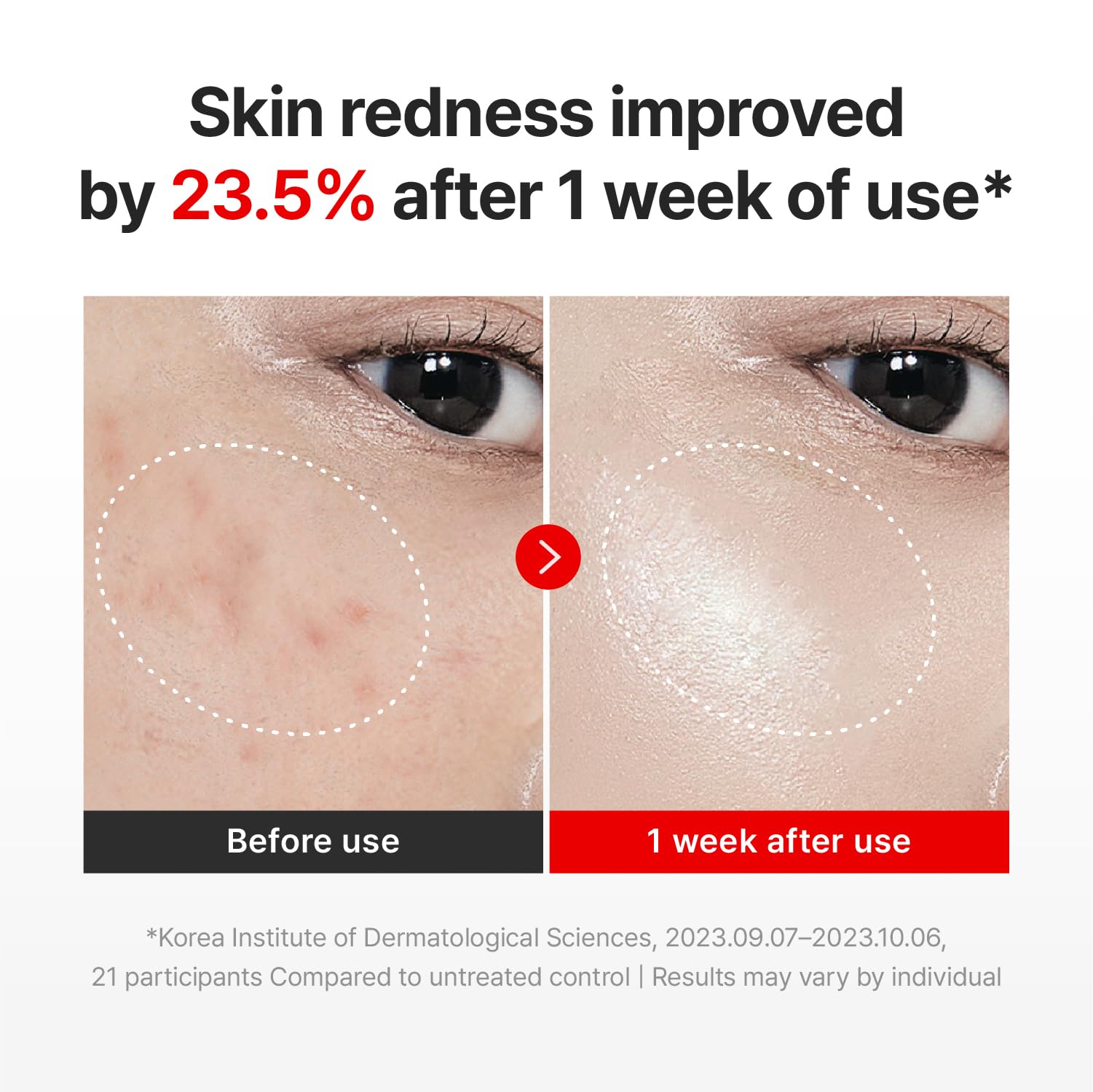 CENTELLIAN 24 Madeca Cream Time Reverse, TECA Moisturizer (2-Pack) - CENTELLIAN 24 Official Product View 5