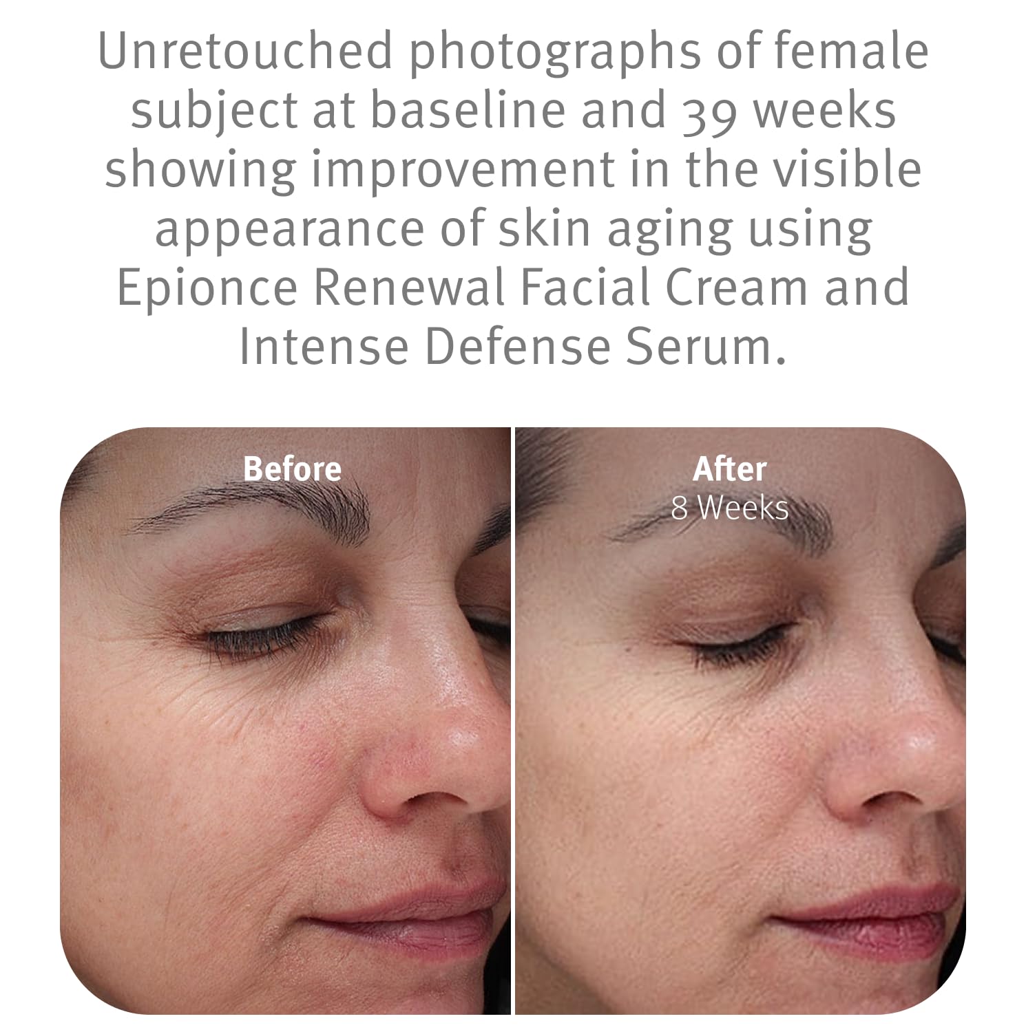 Epionce Renewal Facial Cream Hydrating Anti - Aging Skin Barrier Moisturizer - Epionce Official Product View 5