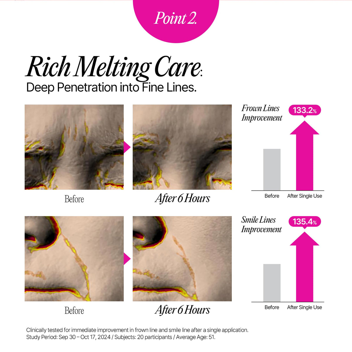 Hydrogel Collagen Face Wrinkle Patches - LOLOSKINNY Official Imagery - 6