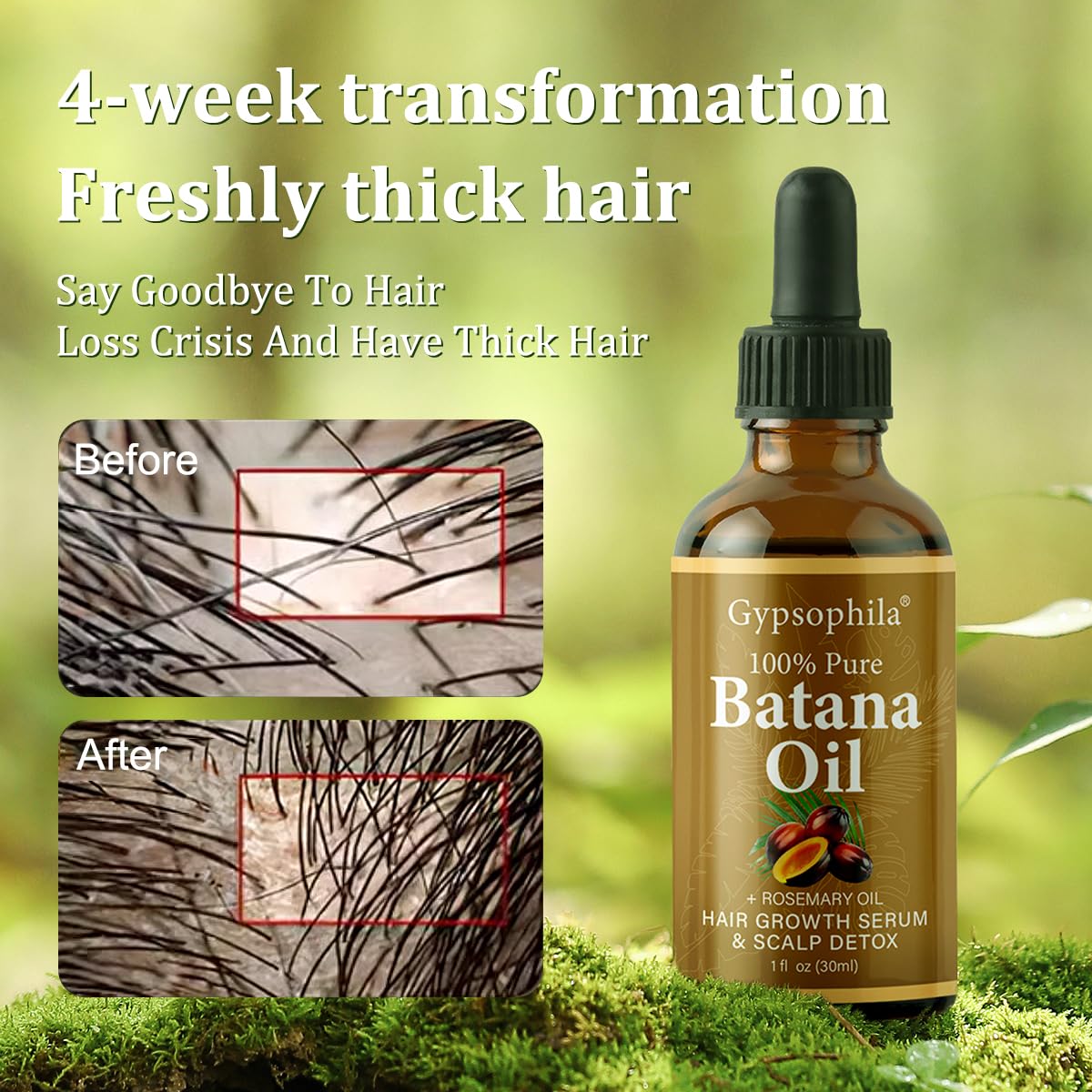 Gypsophila Batana Oil for Hair Growth - 100% Pure Natural Hair Growth Oil & No - Gypsophila Official Product View 3