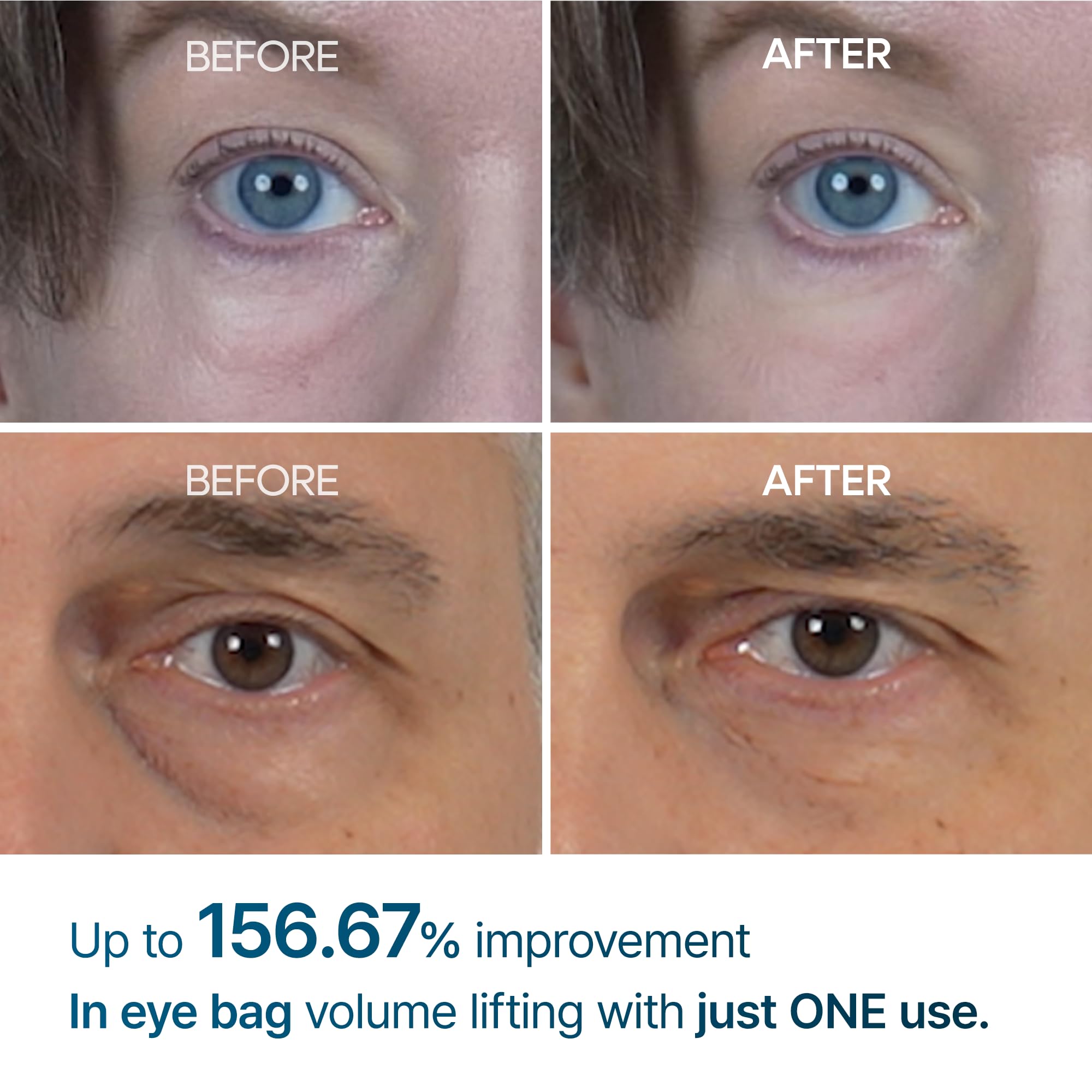 Dr Melaxin Eyephalt Under Eye Cream for Dark Circles and - Dr.Melaxin Official Imagery - 4