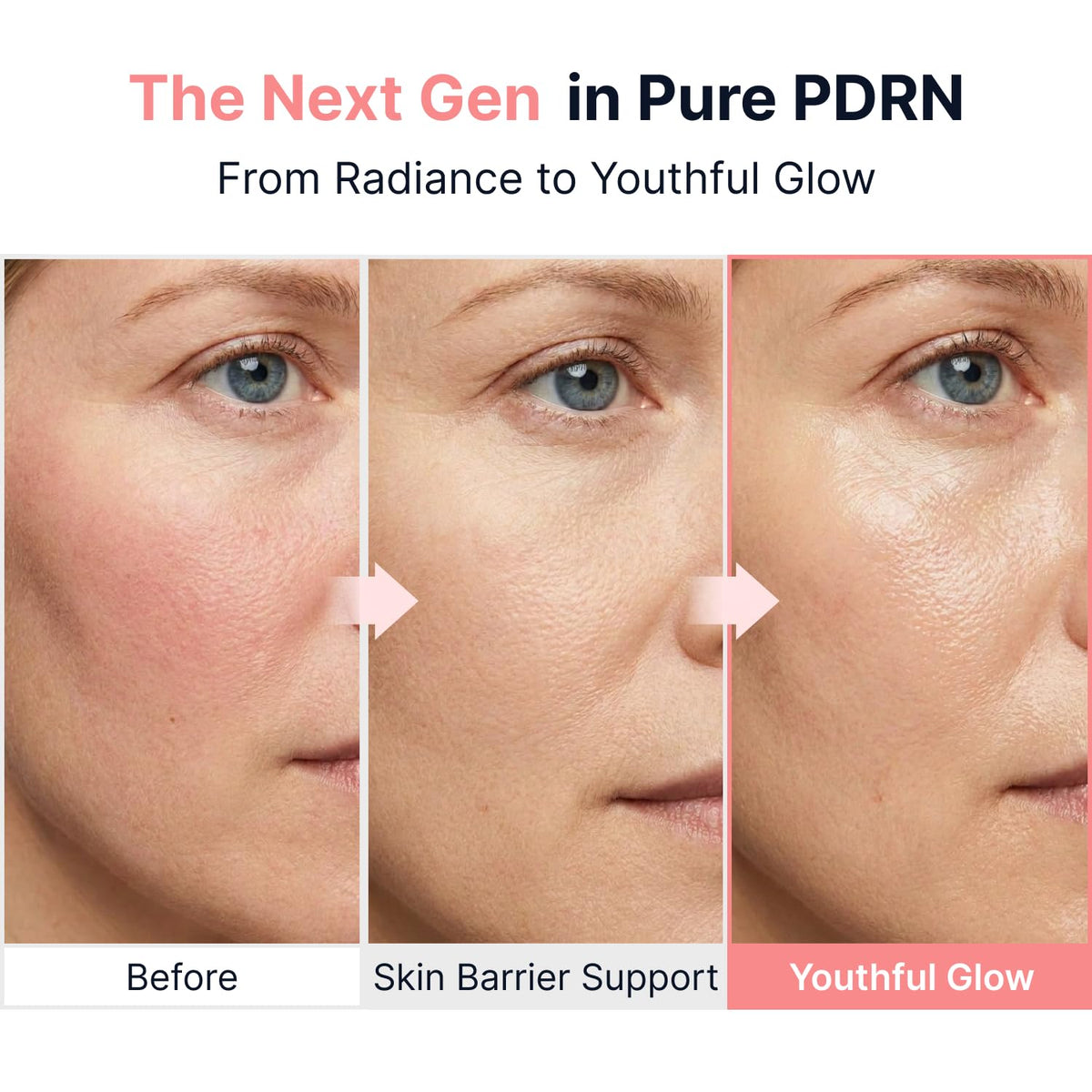 SUNGBOON EDITOR Glow PDRN Ampoule Vitamin B12 Radiant Skin 1 - SUNGBOON EDITOR Official Imagery - 4