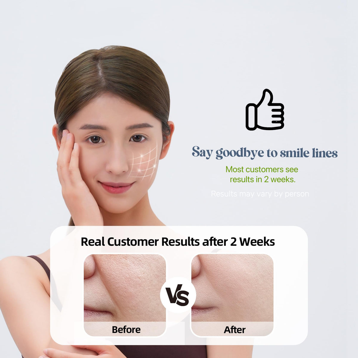 Smile Line Patches Nasolabial Folds Laugh Line Patches Mouth - HYDROSMOOTH Official Imagery - 4