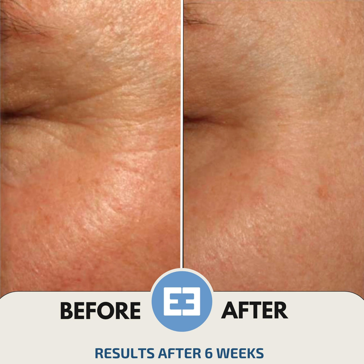 EiE Klotho Peptides Serum Hydrating Anti Aging Hyaluronic - Leverage x Evolution Official Imagery - 7