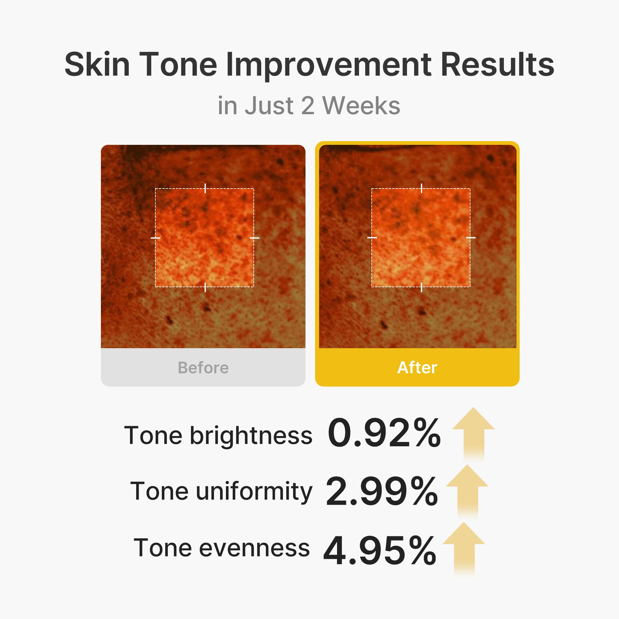 medicube Capsule Cream with Kojic Acid & Turmeric for Uneven Skin Tone - View 5