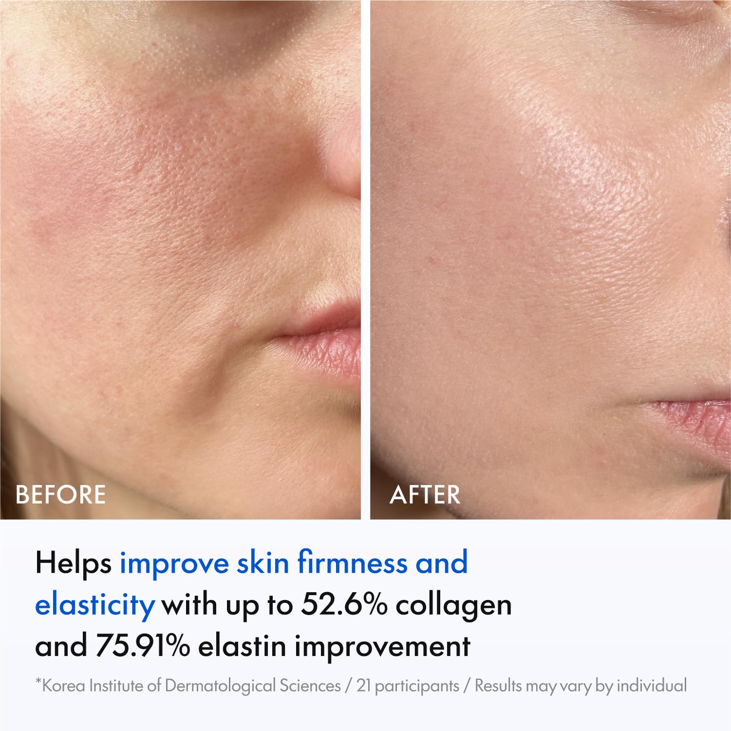 PDLLA Collagen Mask for Glass Skin Glow &amp; Firming - JUVELOOK