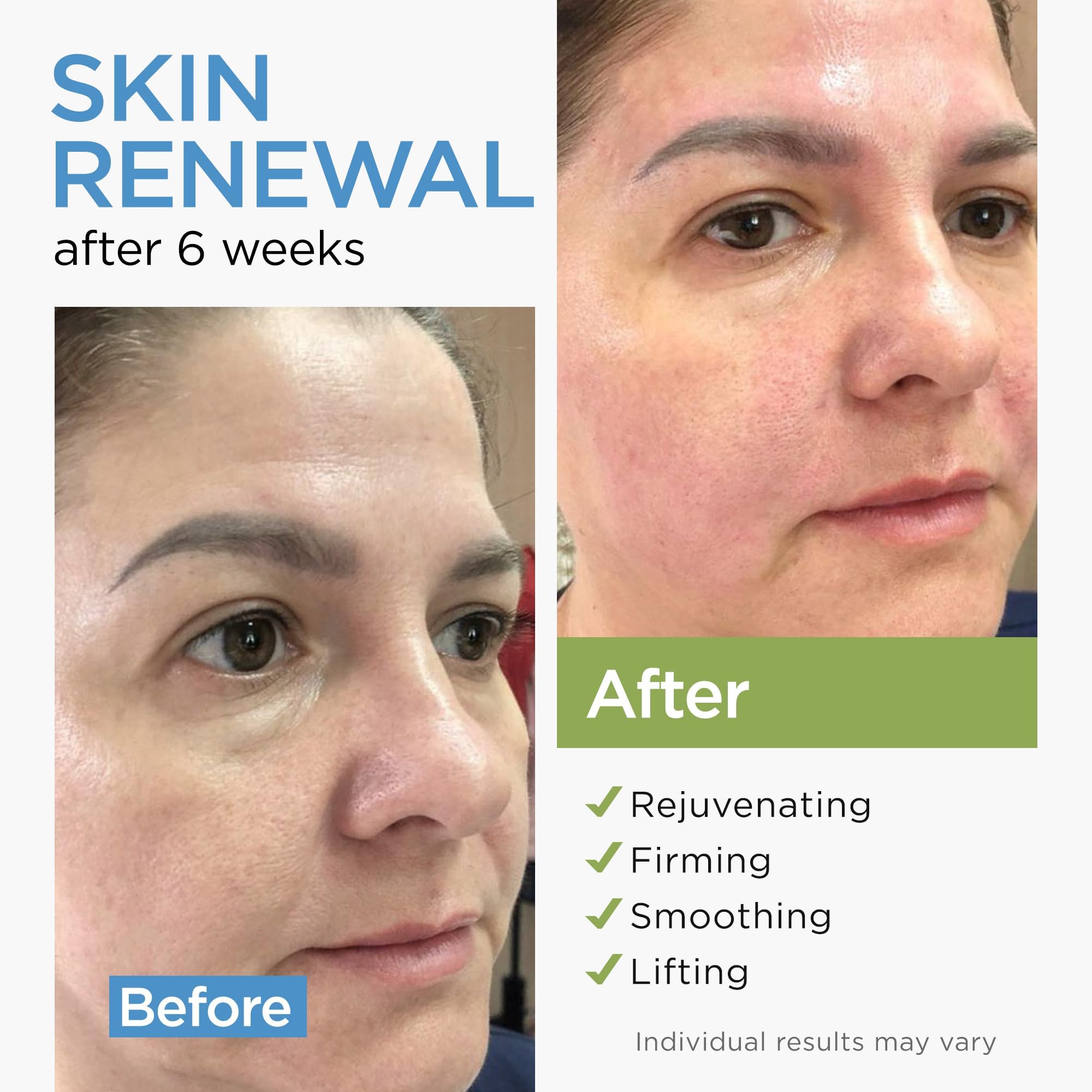 Collagen Stem Cell Cream with Retinol, Hyaluronic Acid 1.7 Oz - Ember Cloud