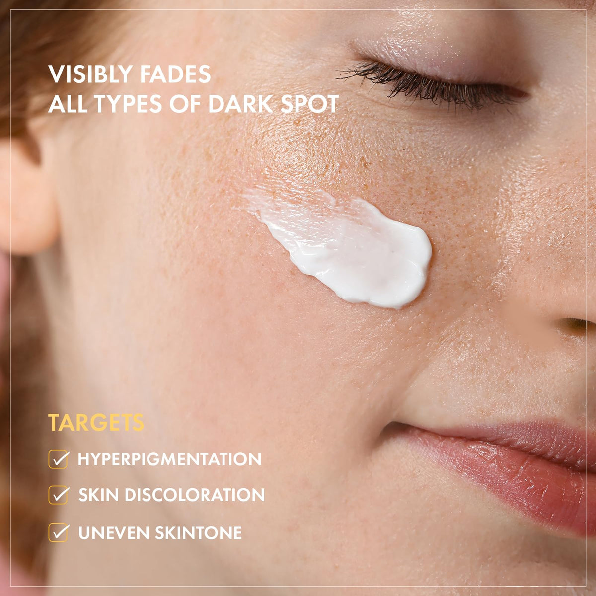 TOSOWOONG 8 Days Spot Cream for Dark Spots Freckles Uneven - TOSOWOONG Official Imagery - 5