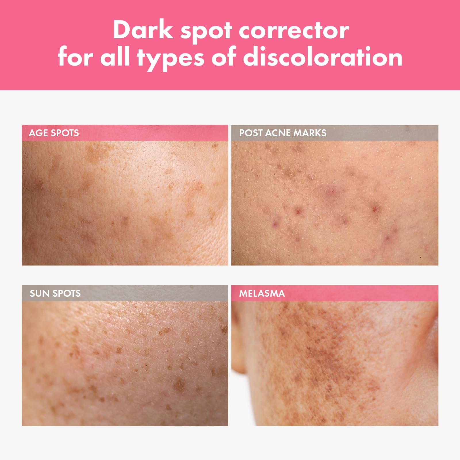 TOSOWOONG Arbutin 7 Intensive Spot Cream for Dark Spots - TOSOWOONG Official Product Imagery - 3