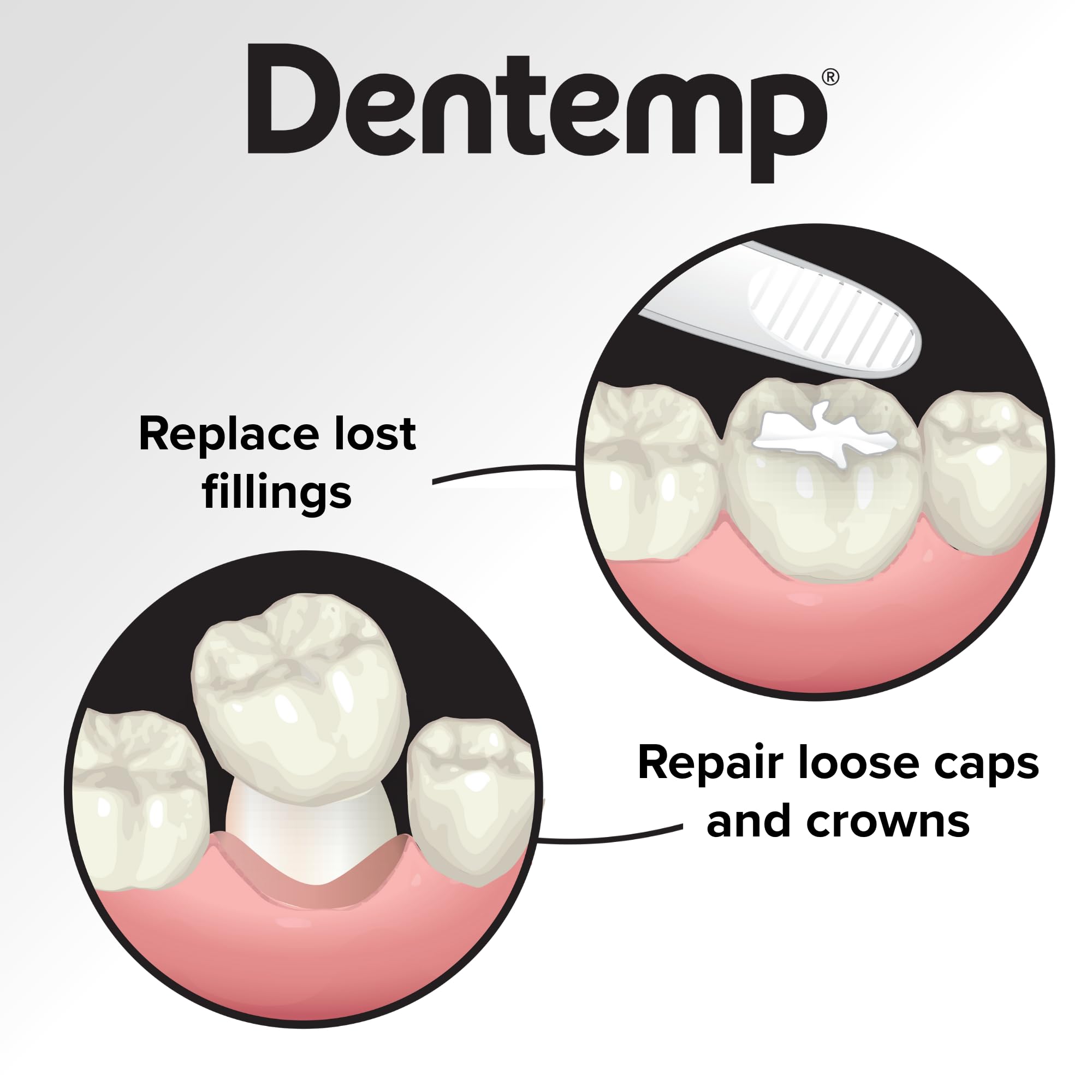 Dentemp Maximum Strength Loose Cap & Lost Filling Repair Kit – 5g (1pk)
