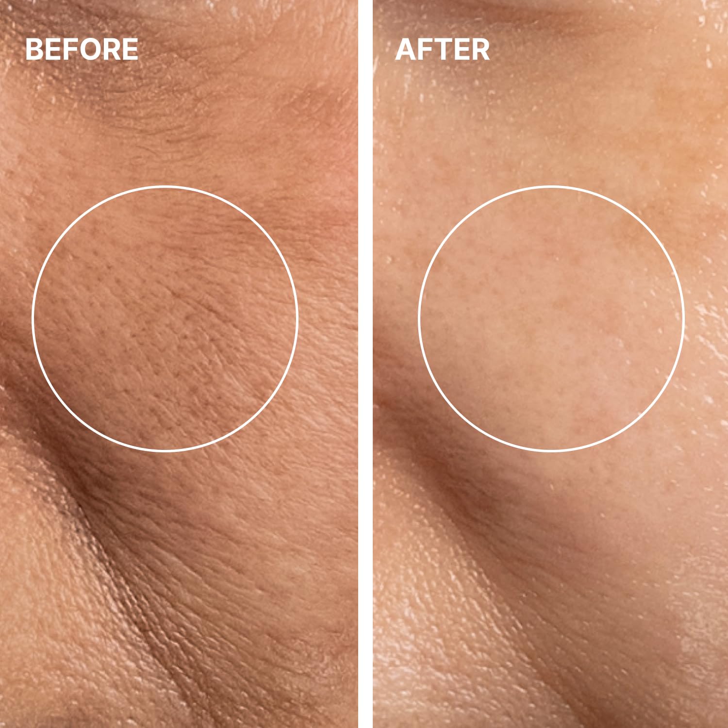 G-Peel Program Refill Kit (Acts 1, 2, 3), 3-Step Korean Skincare - THOME