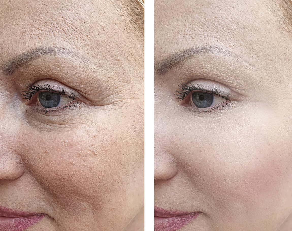 Vitality Precision Skin Phloretin C Serum - Precision Skin RX Official Imagery - 4