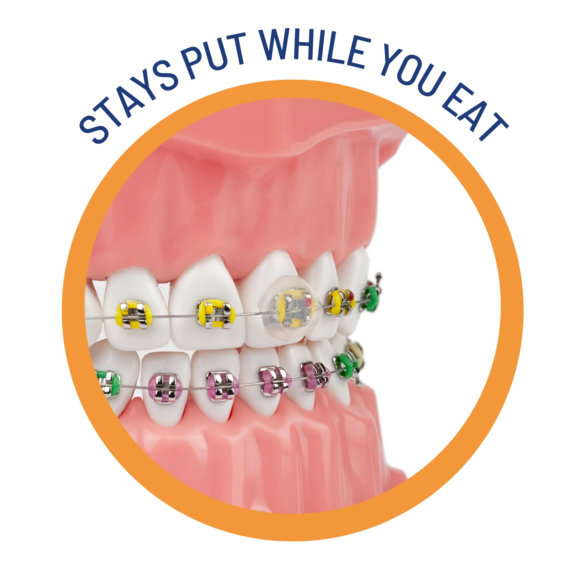OrthoDots CLEAR Braces Wax Alternative by ORVANCE