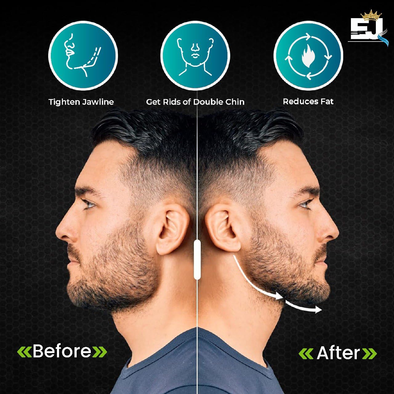 EdJay Jaw Exerciser – Mouth Workout Device, Muscle Trainer for... - EDJAY Official Product View 8