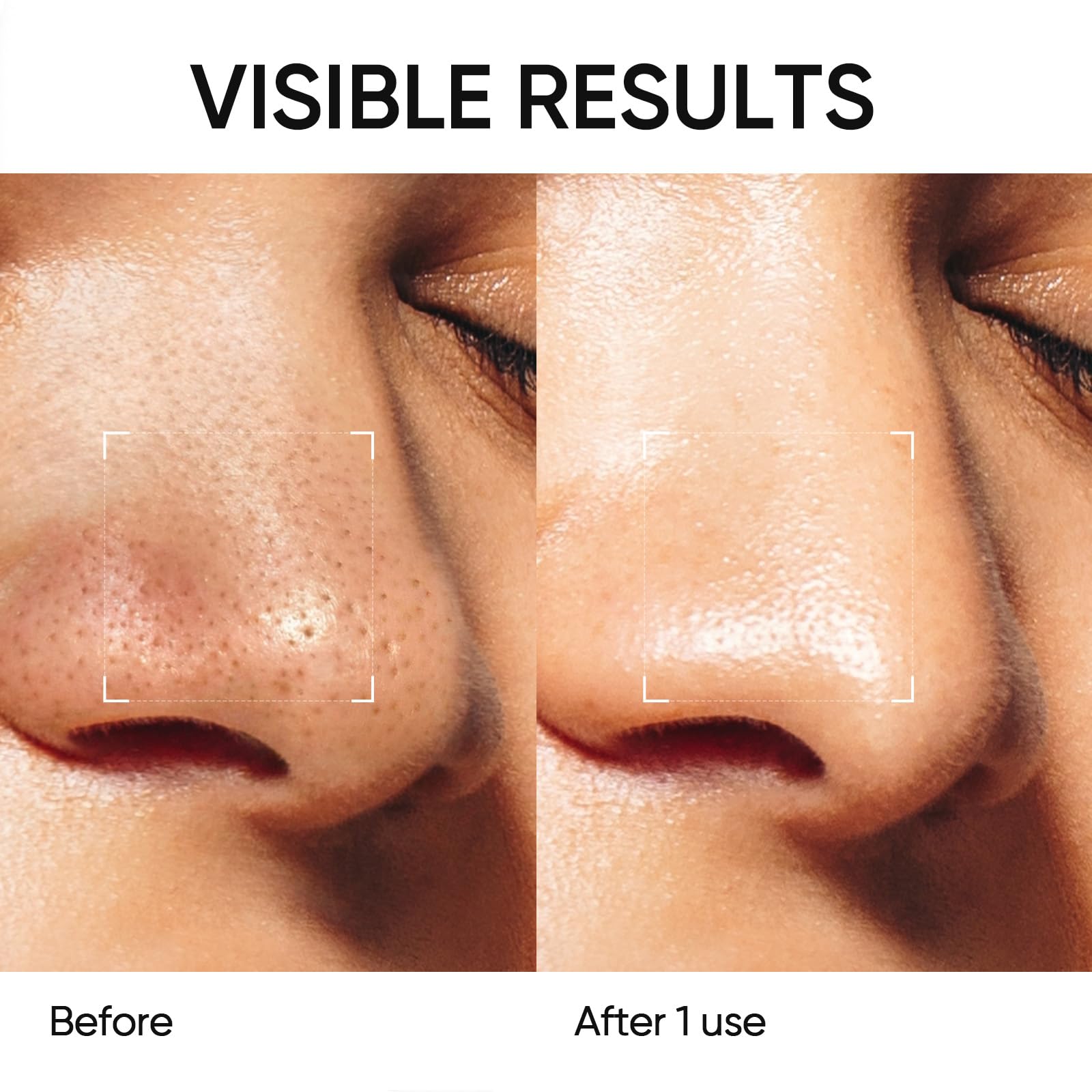SKINTIFIC Deep Pore Cleansing Blackhead Remover Face Mask Stick, - SKINTIFIC