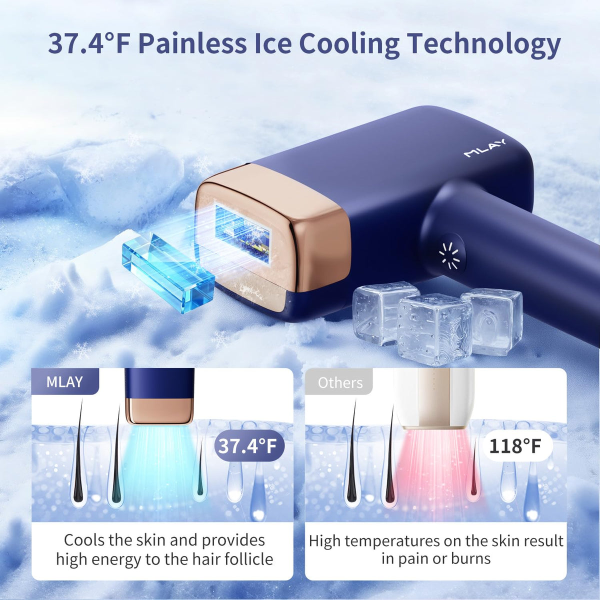 MLAY IPL Laser Hair Removal Ice Cooling Hair Removal Device - MLAY Official Imagery - 3