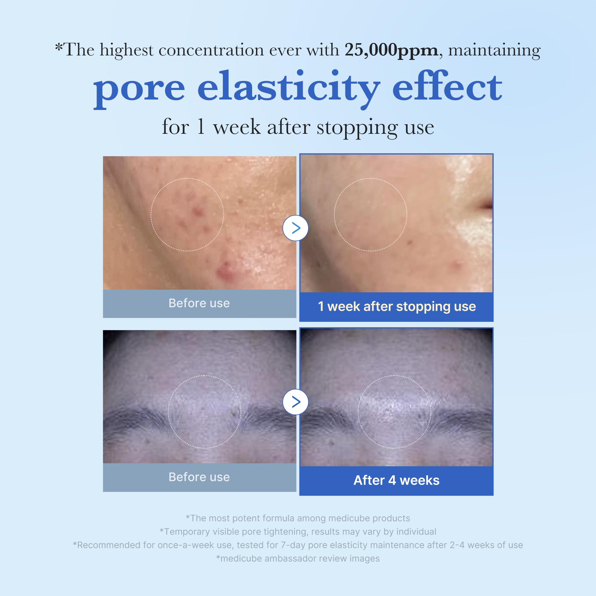 medicube Exosome Shot Zero 25,000 PPM Spicule Facial Serum - View 3