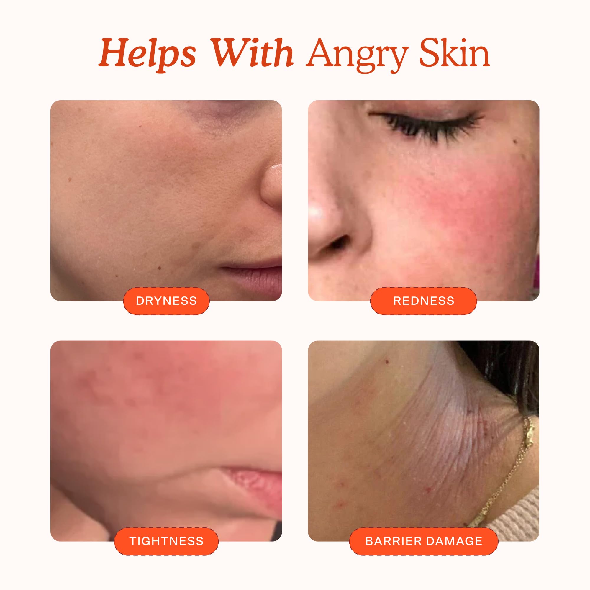 Tower 28 SOS Recovery Hydrating Face Cream for Sensitive - Tower 28 Official Imagery - 4