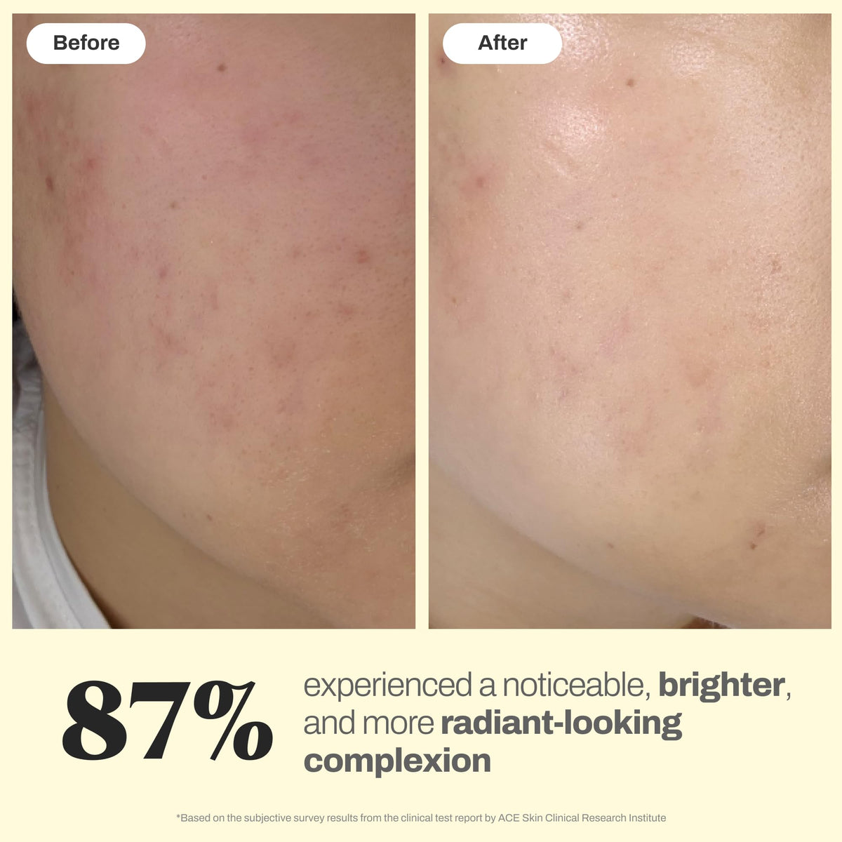 Brightening Glow Essence - Aeluri Formula Official Imagery - 6